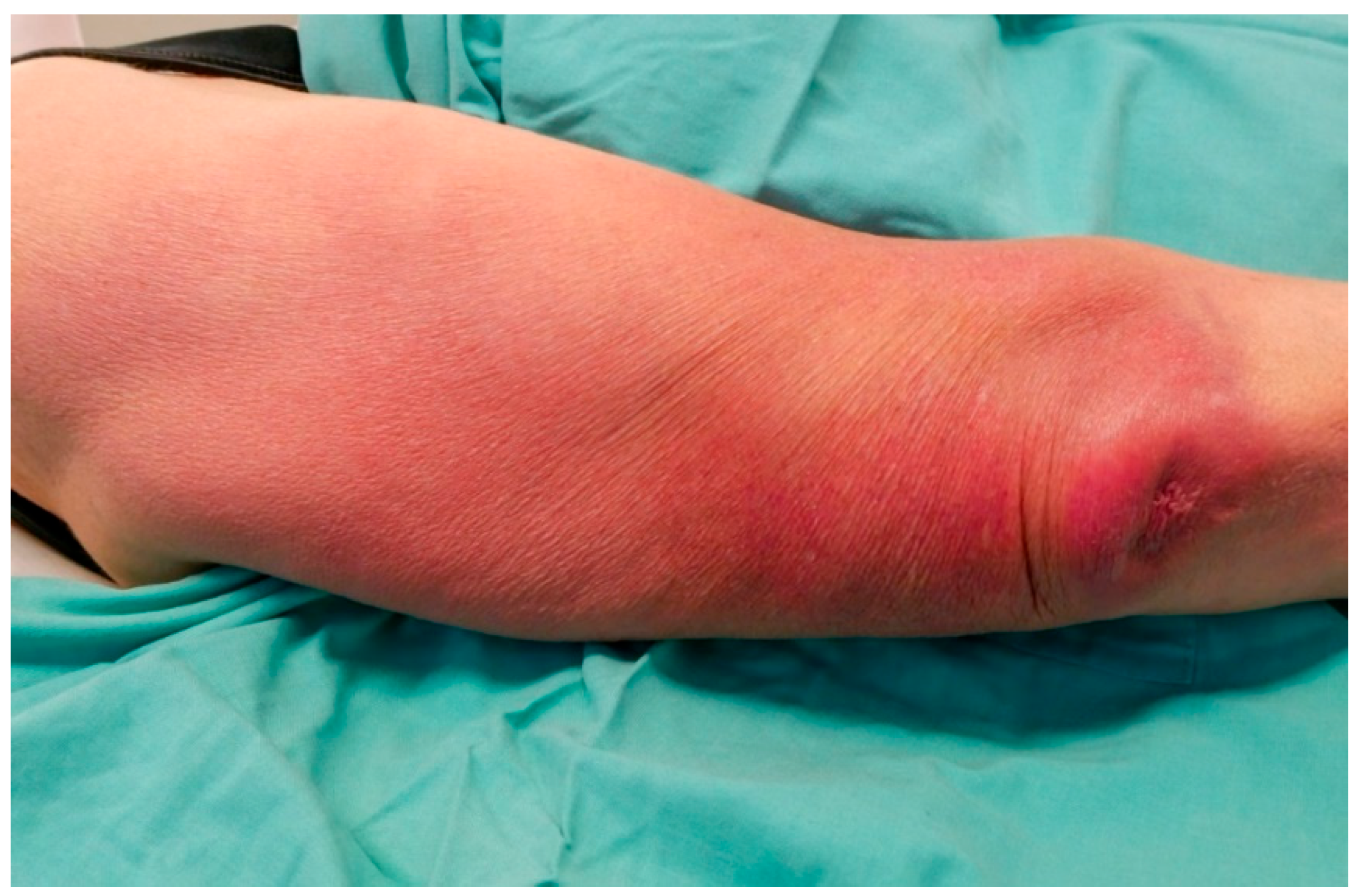 Dermato 04 00005 g001