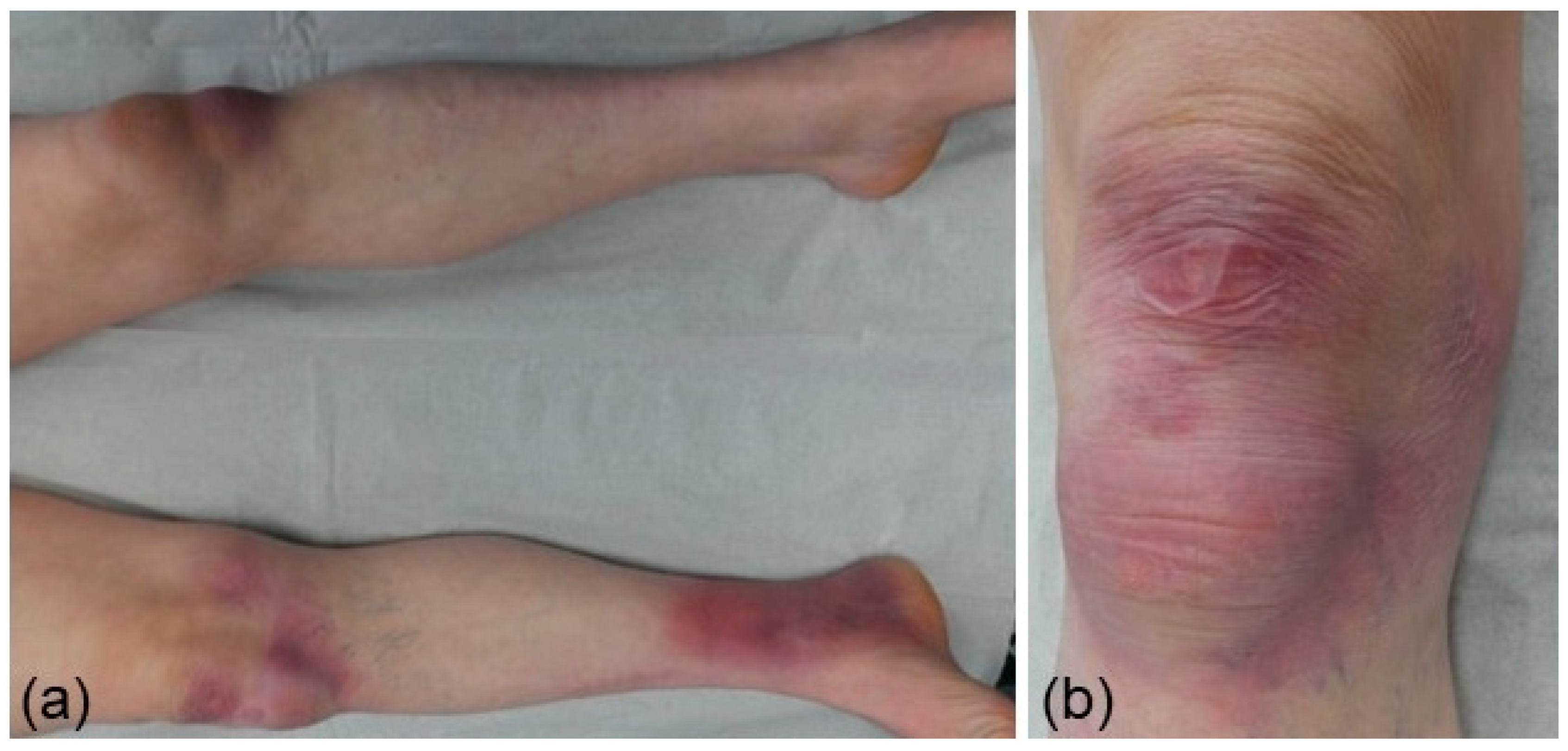 Dermato 04 00005 g003