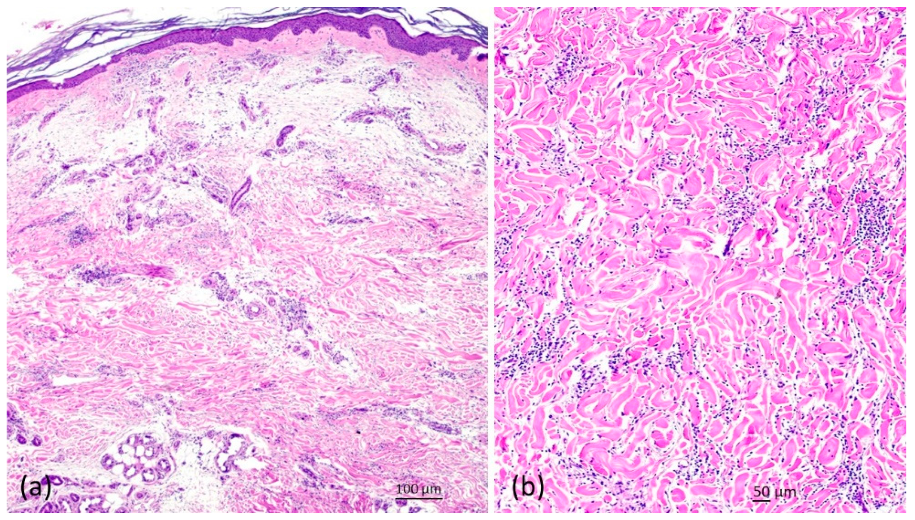 Dermato 04 00005 g004