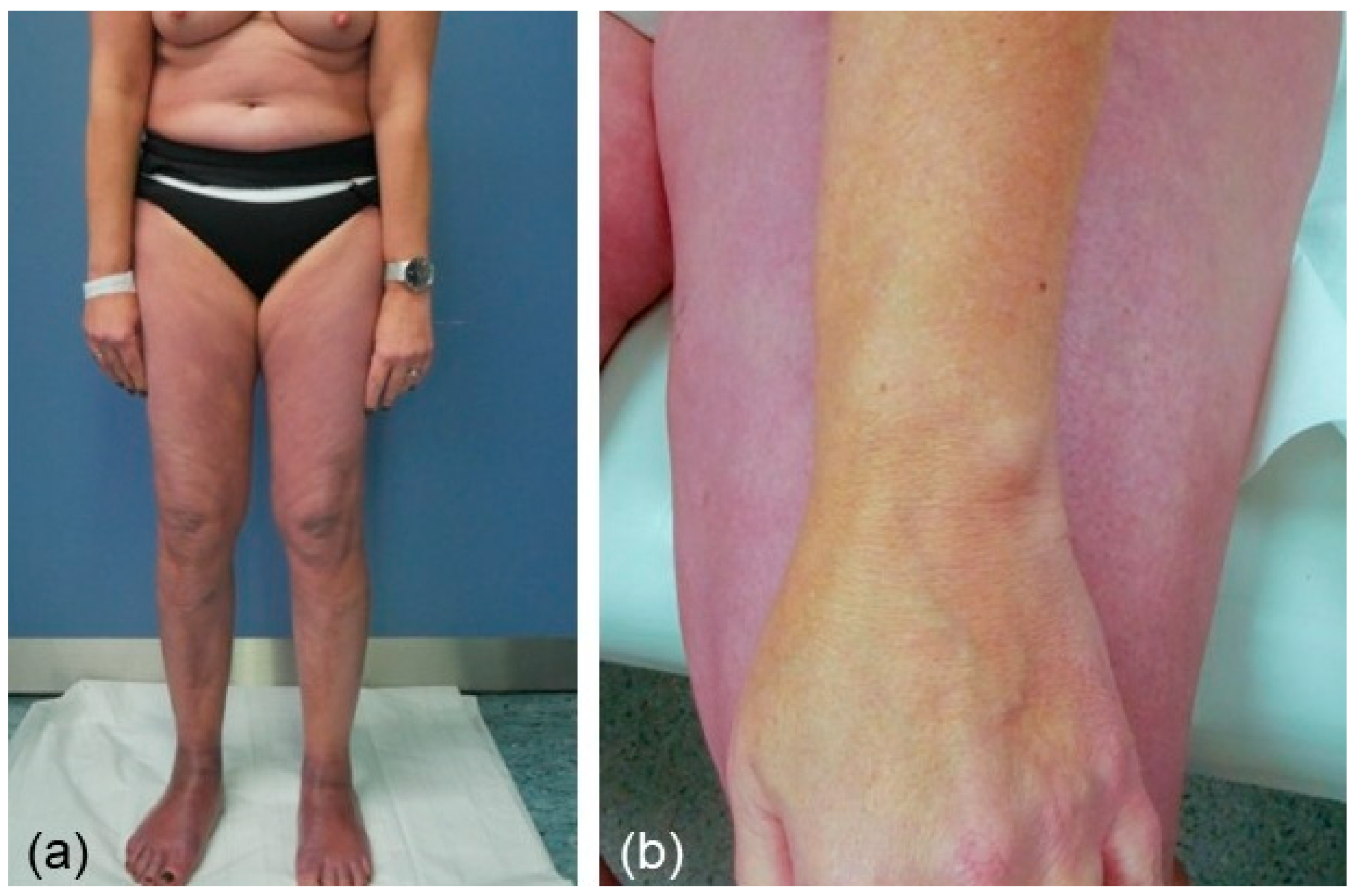 Dermato 04 00005 g005