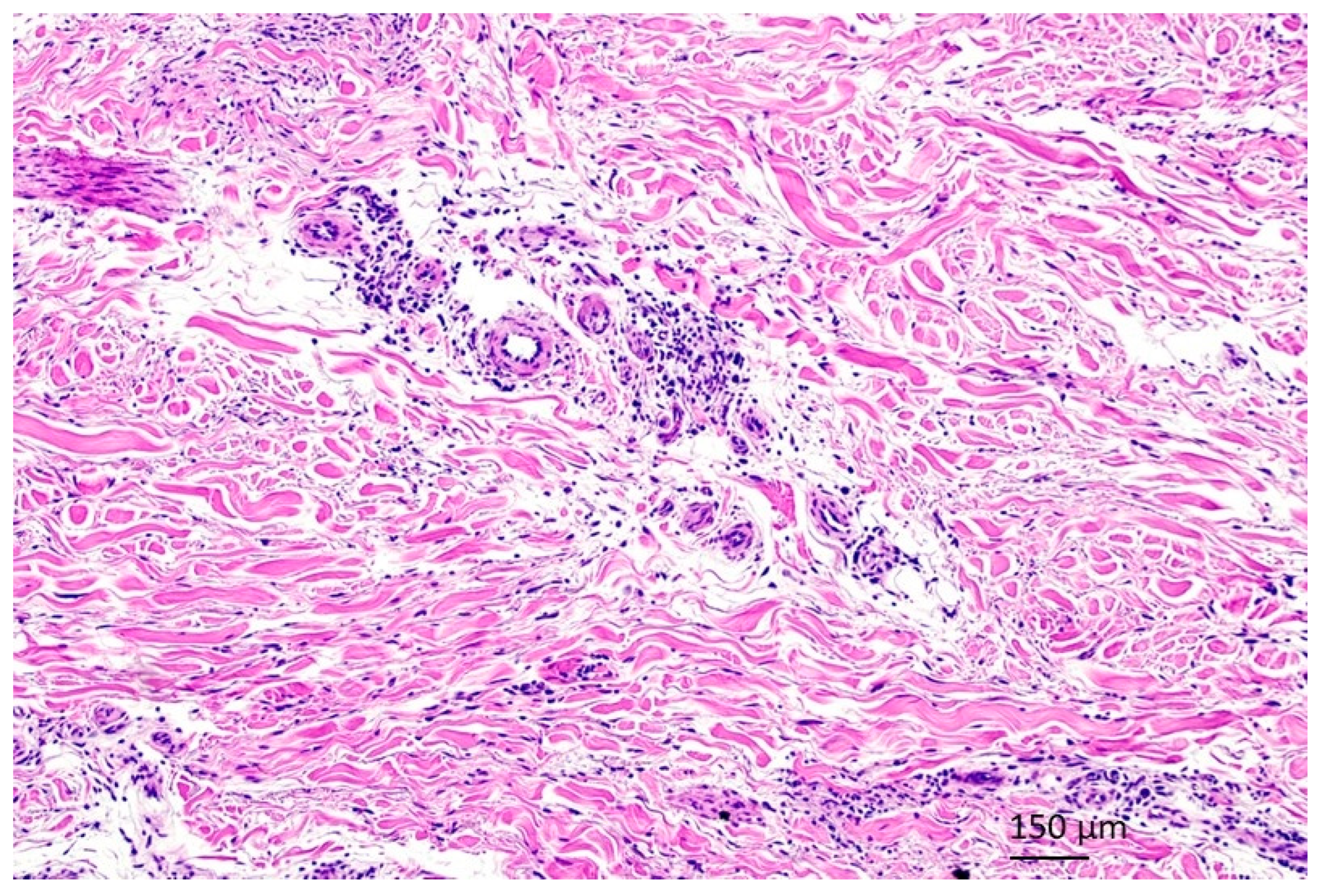 Dermato 04 00005 g006