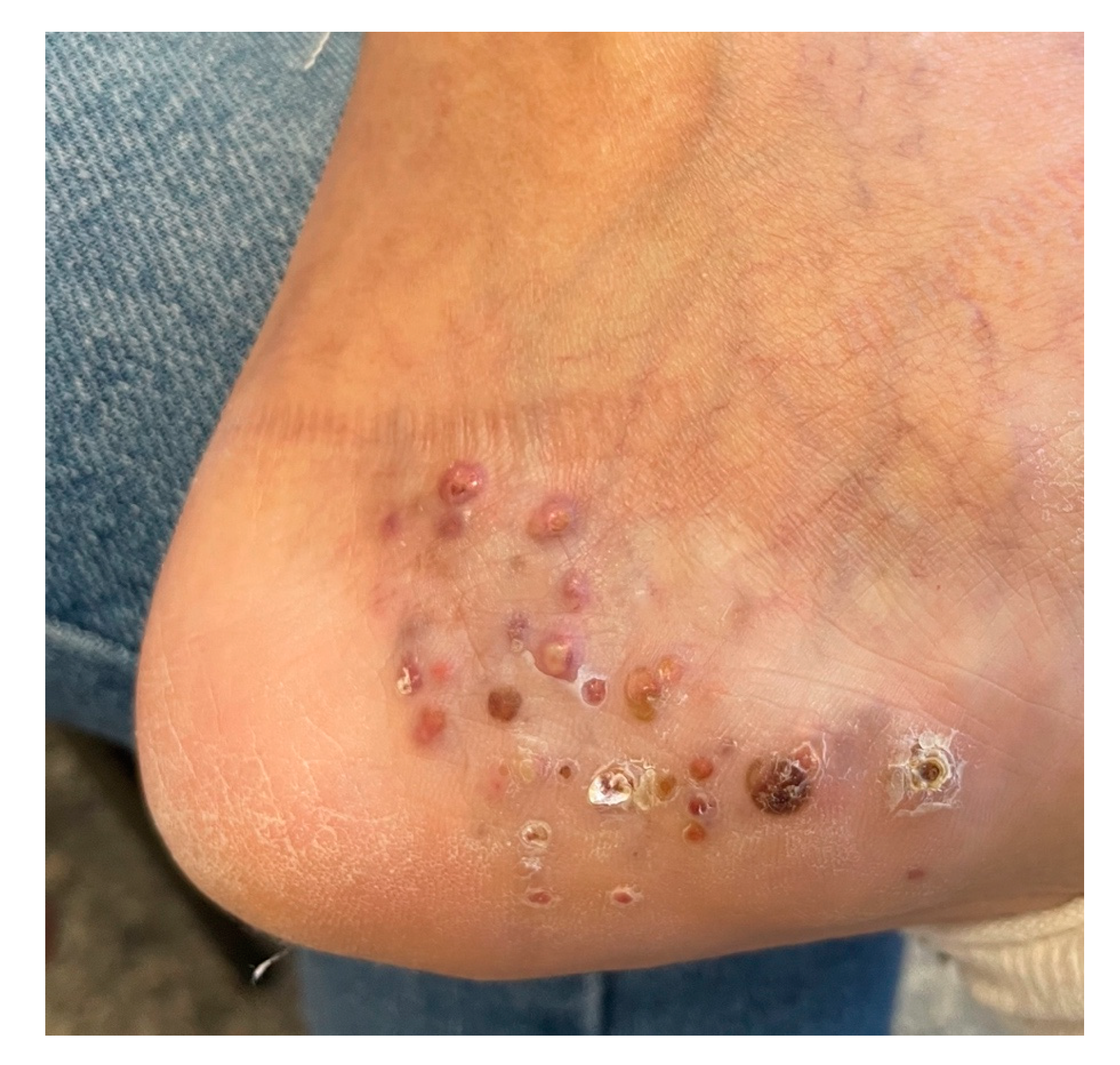 Dermato 04 00008 g001