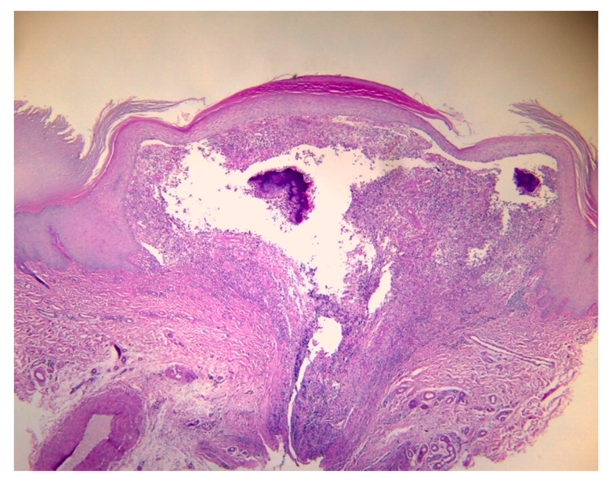 Dermato 04 00008 g005