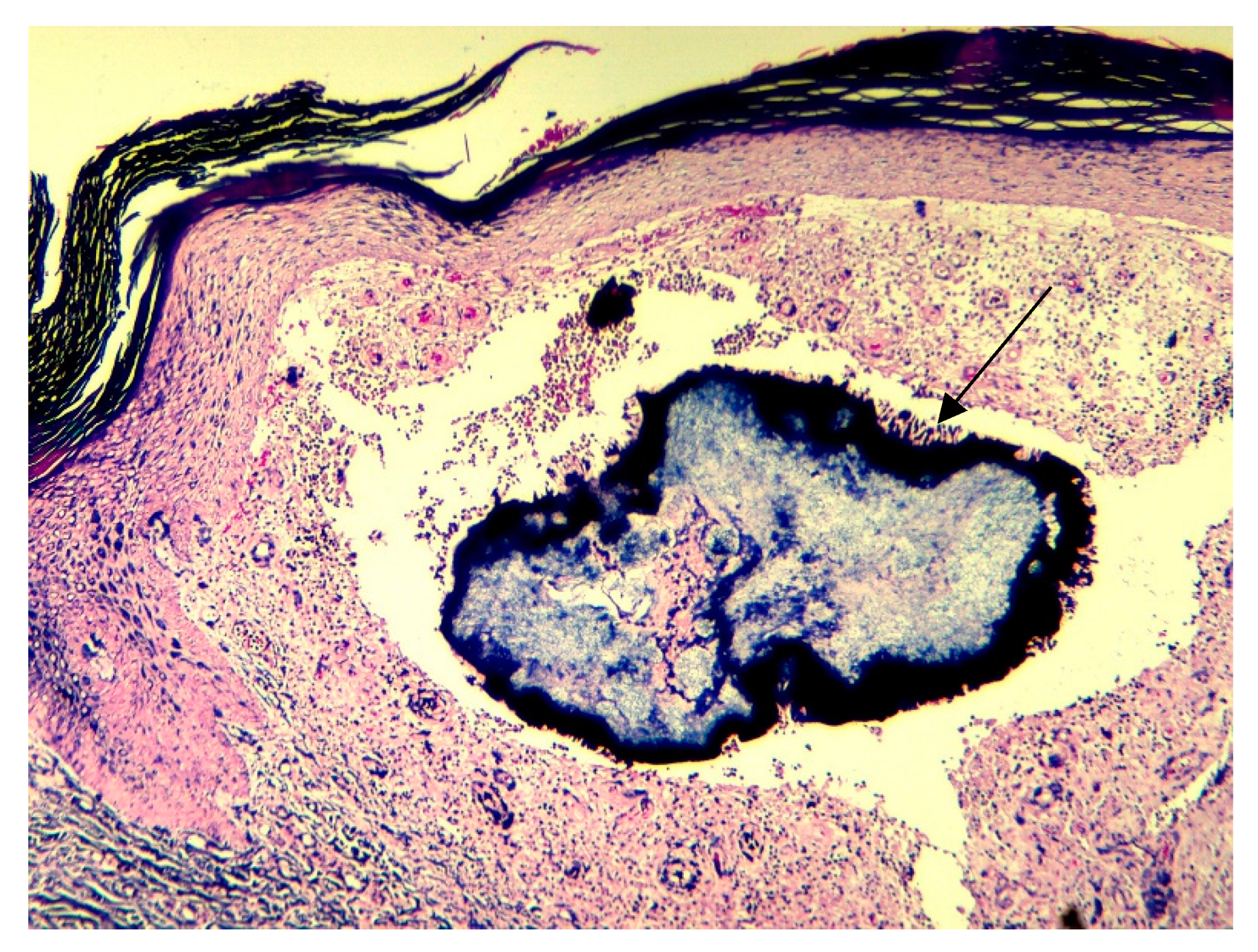 Dermato 04 00008 g006