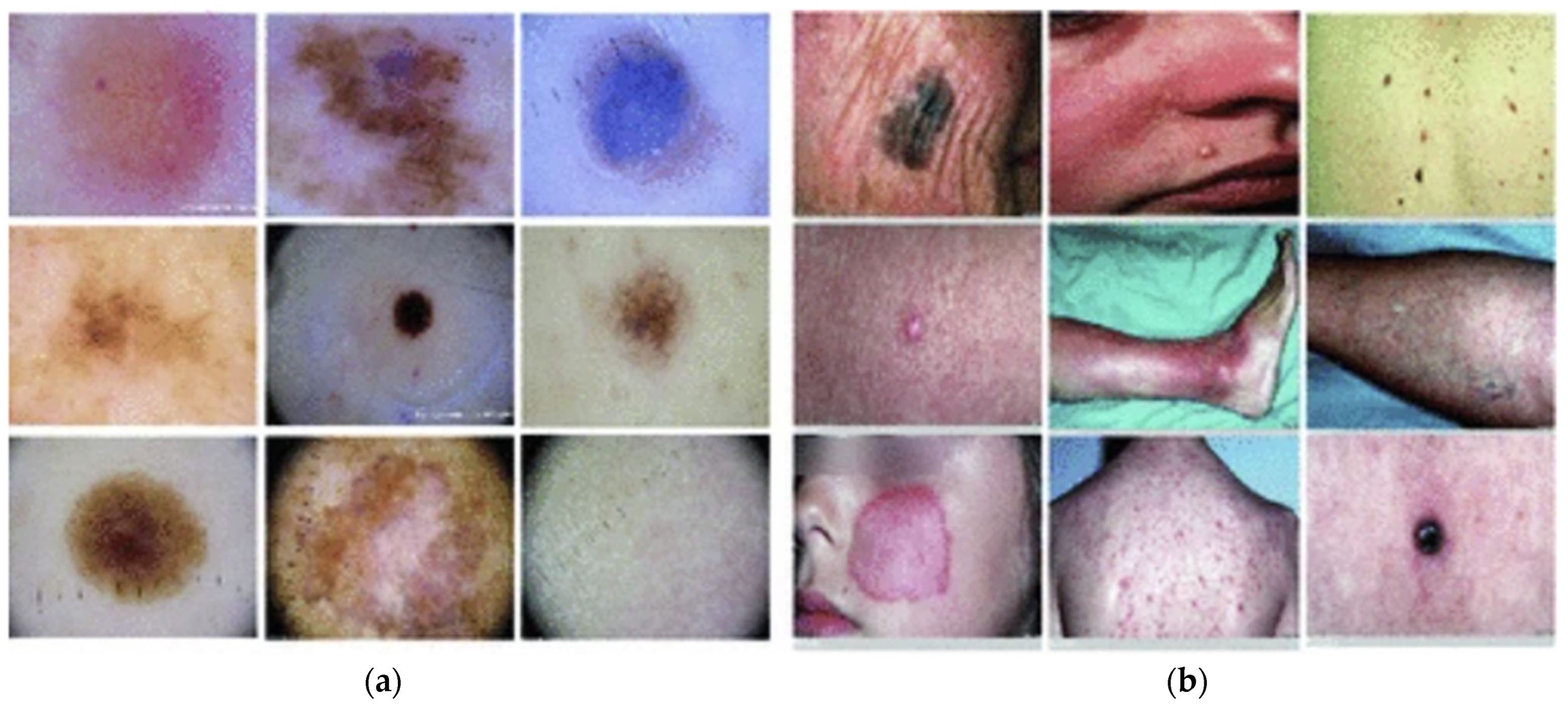 Dermato 04 00011 g002 Dermato 04 00011 g002