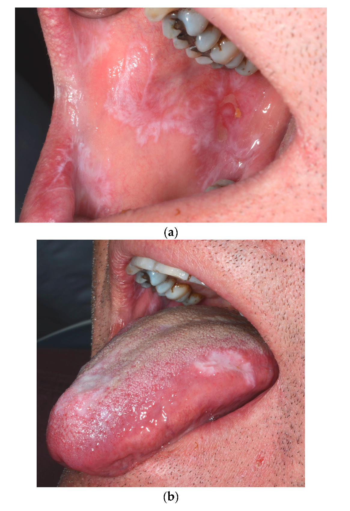 Dermatopathology 07 00004 g001a Dermatopathology 07 00004 g001a