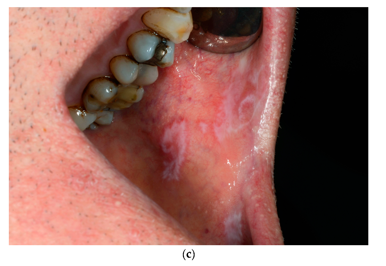 Dermatopathology 07 00004 g001b Dermatopathology 07 00004 g001b