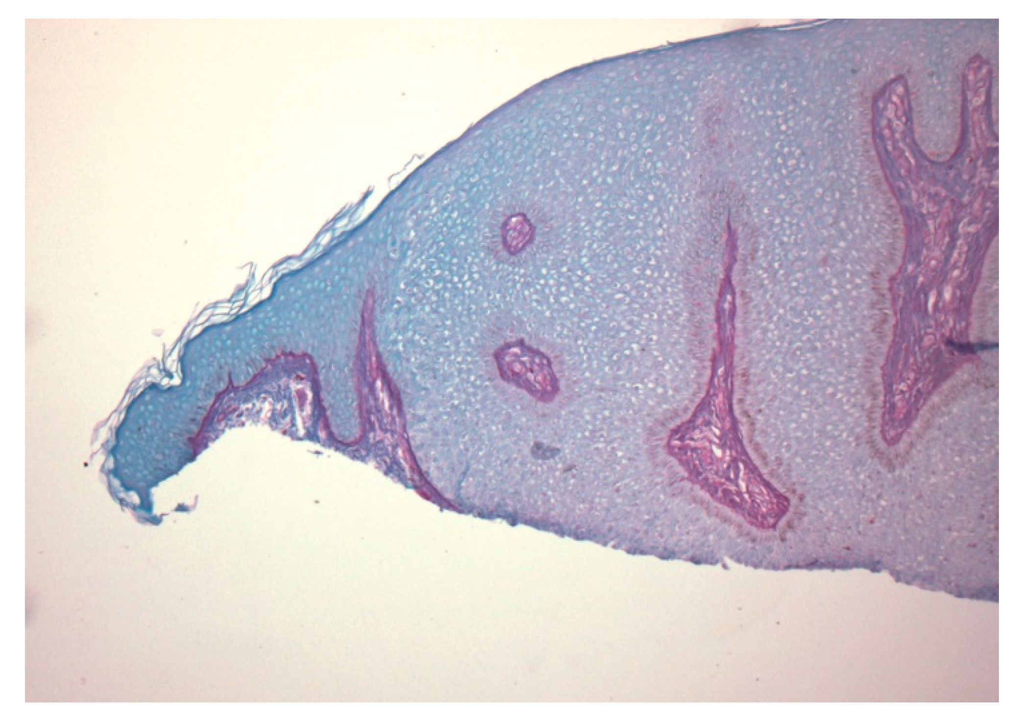Dermatopathology 07 00005 g004