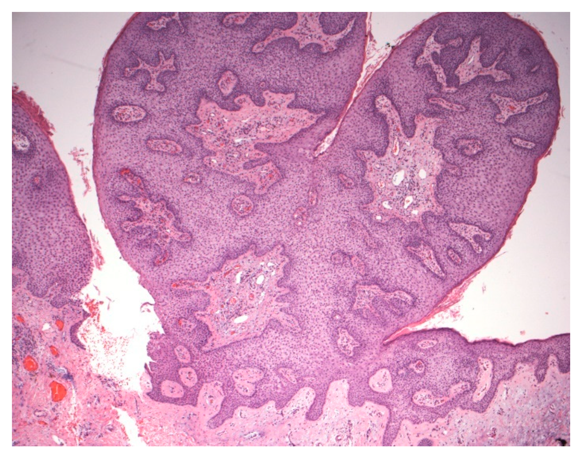 Dermatopathology 07 00005 g006
