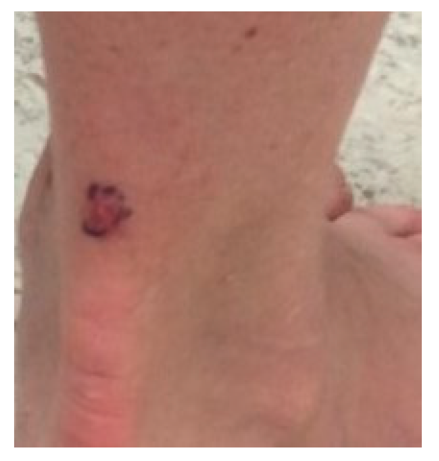 Dermatopathology 07 00005 g007