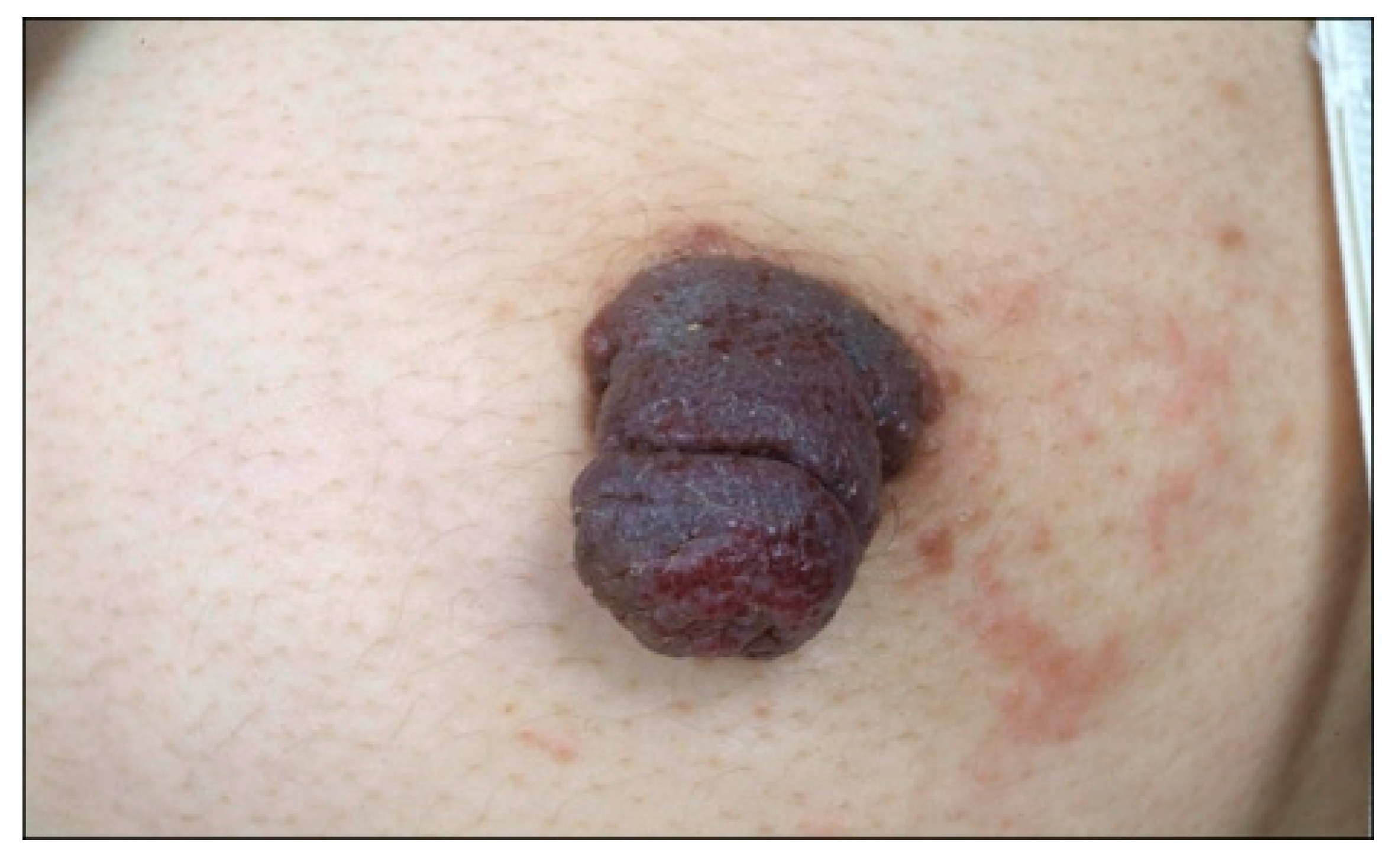 Dermatopathology 07 00005 g008