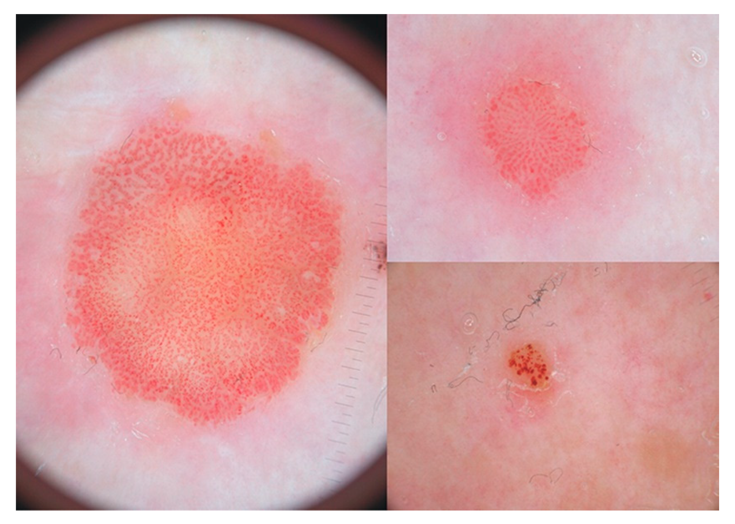 Dermatopathology 07 00005 g009