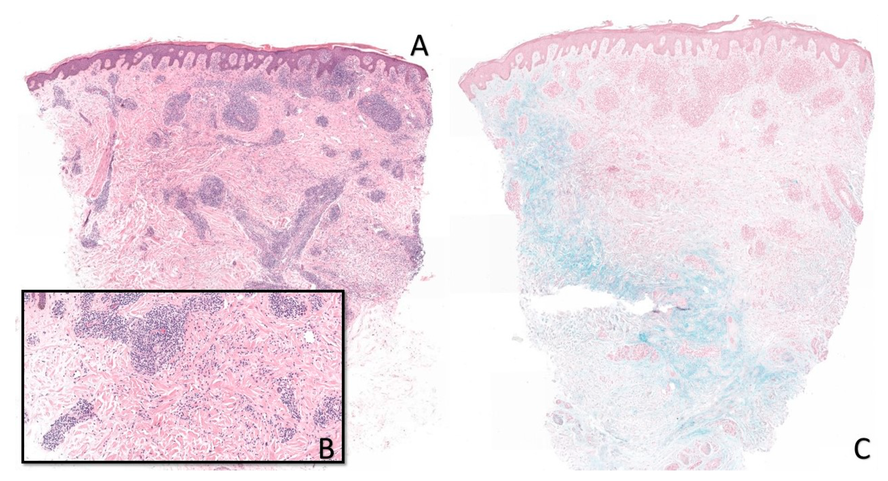 Dermatopathology 07 00006 g002