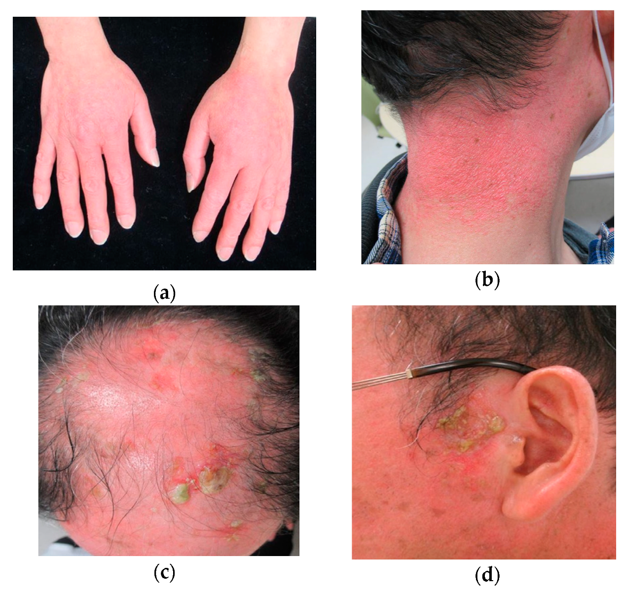 Dermatopathology 07 00008 g001