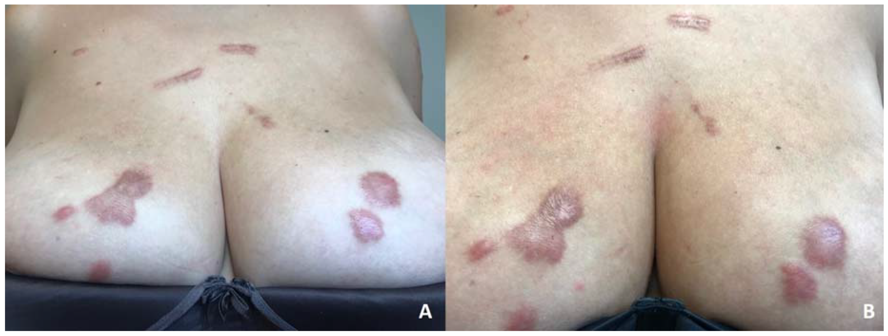 Dermatopathology 07 00009 g001