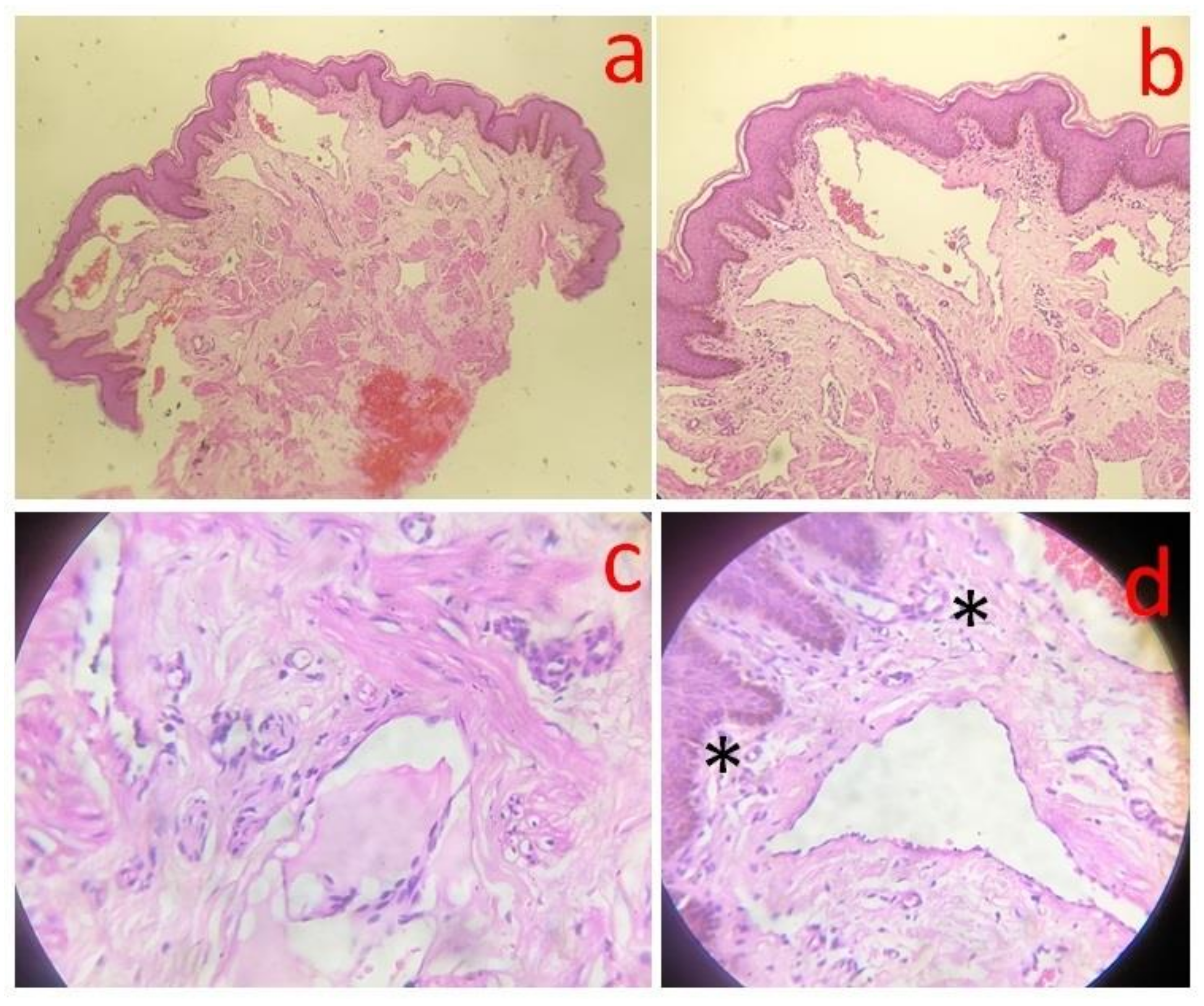Dermatopathology 08 00002 g004
