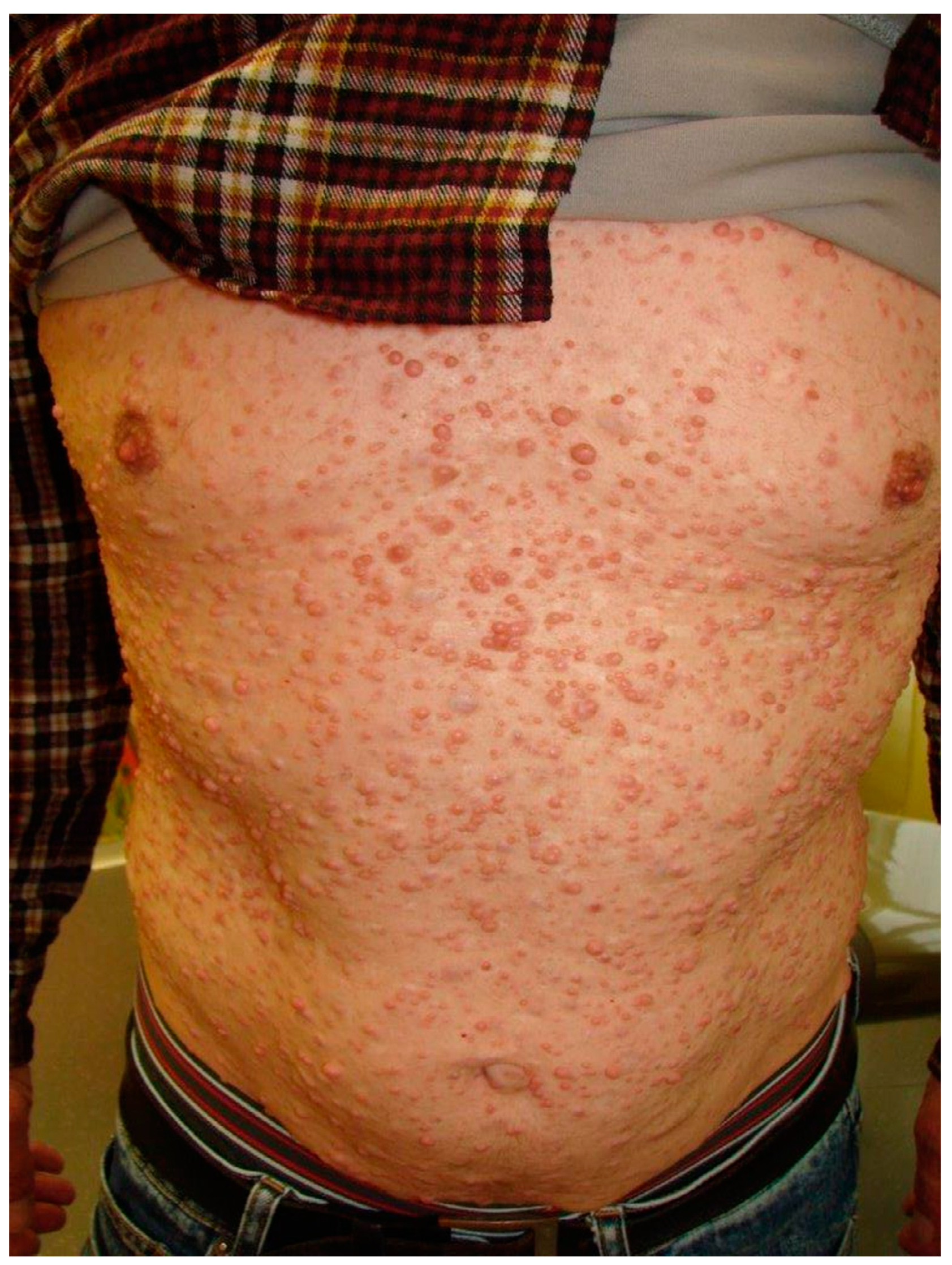 Dermatopathology 08 00003 g001