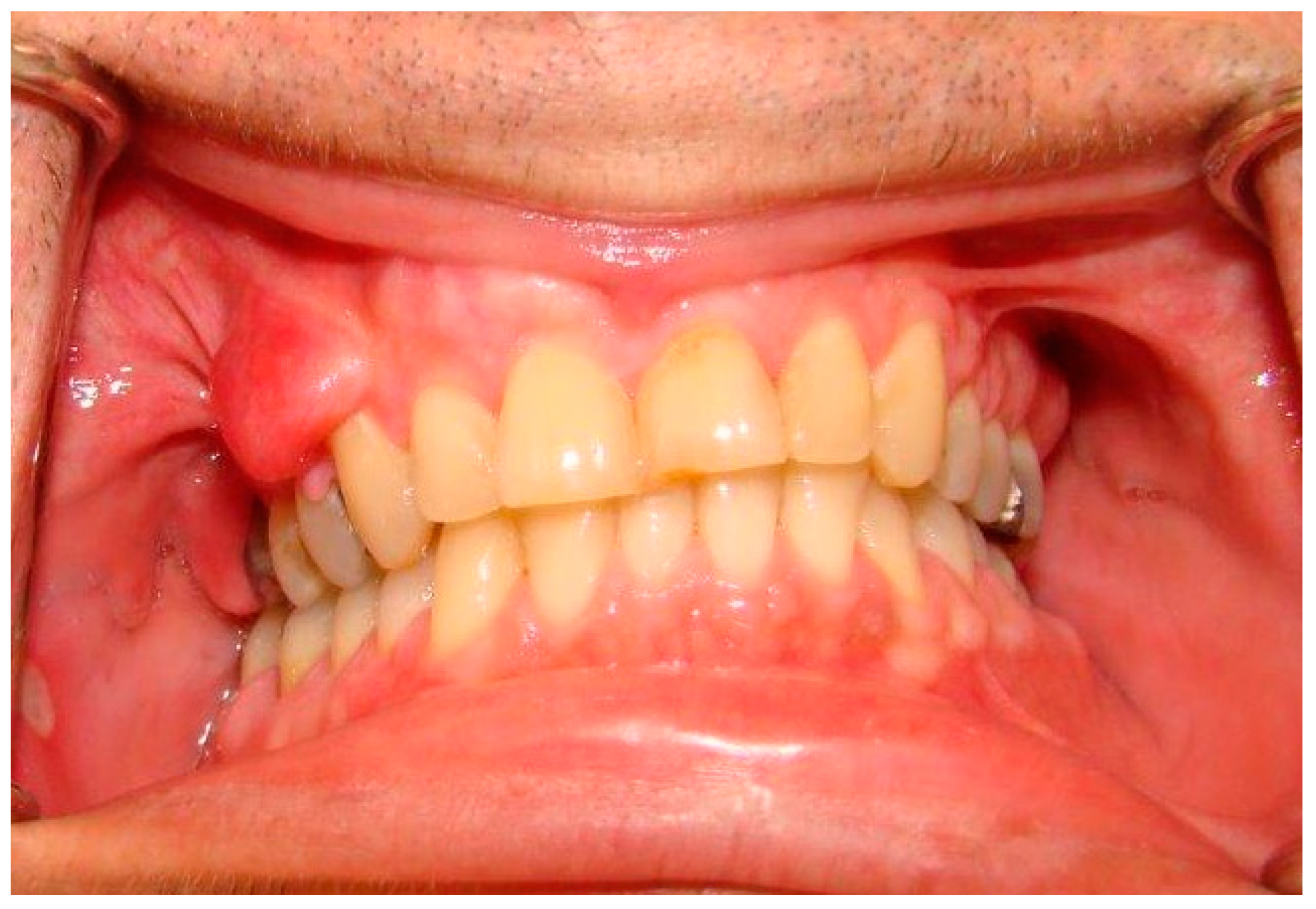 Dermatopathology 08 00003 g002