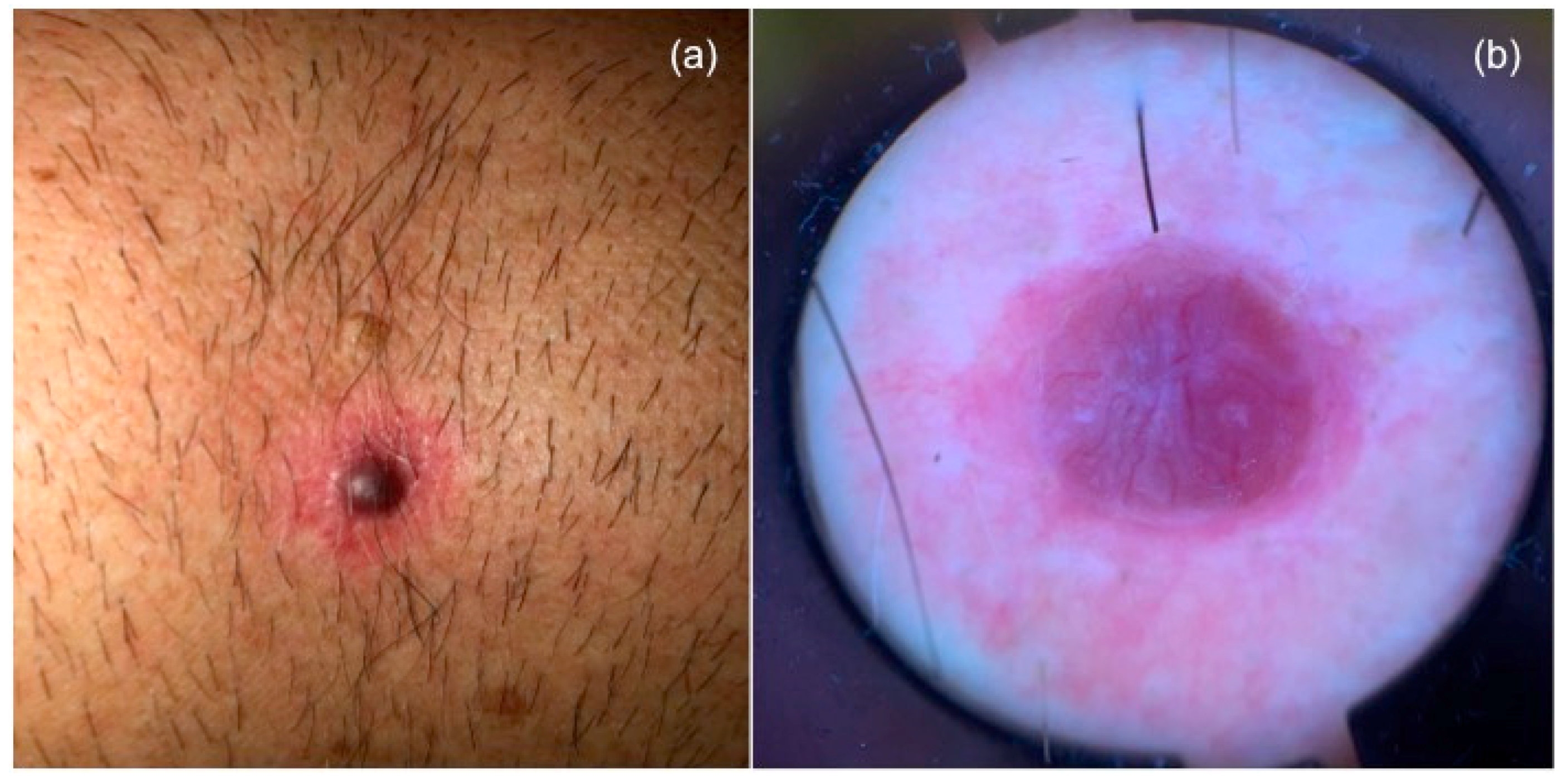 Dermatopathology 08 00005 g001