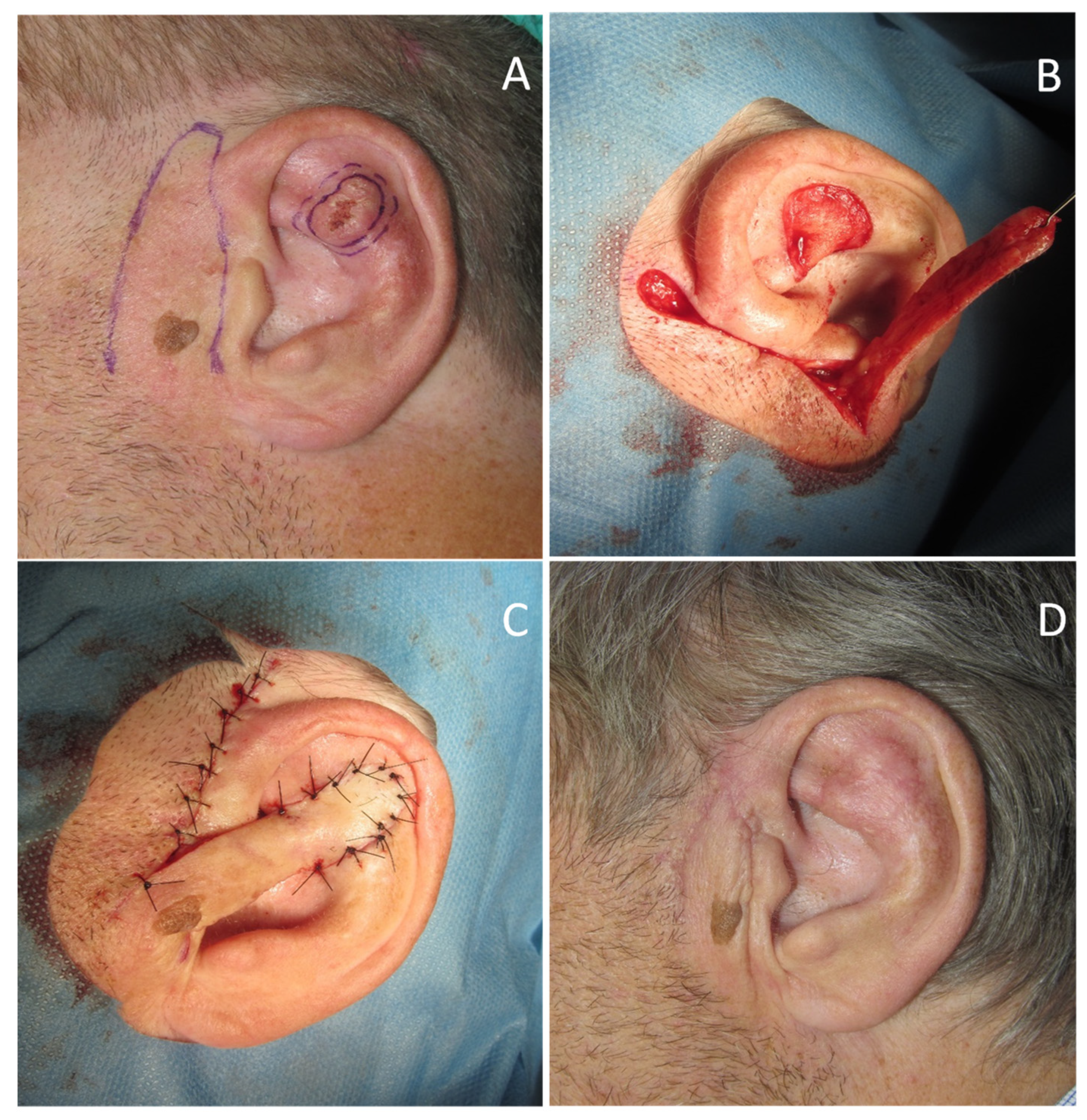 Dermatopathology 08 00009 g004