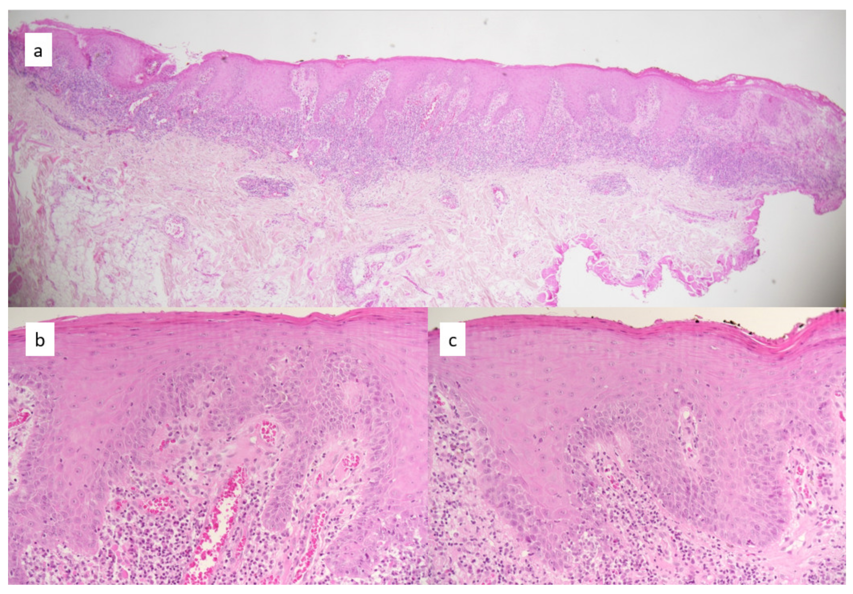 Dermatopathology 08 00013 g001 Dermatopathology 08 00013 g001