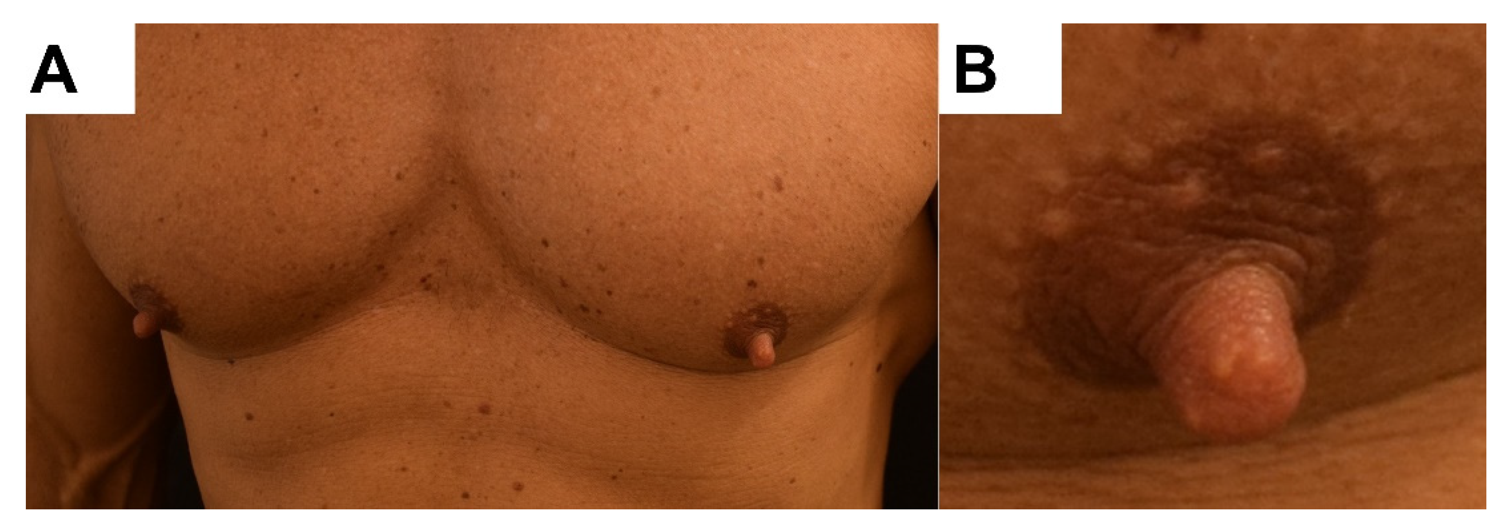 Dermatopathology 08 00016 g001 Dermatopathology 08 00016 g001