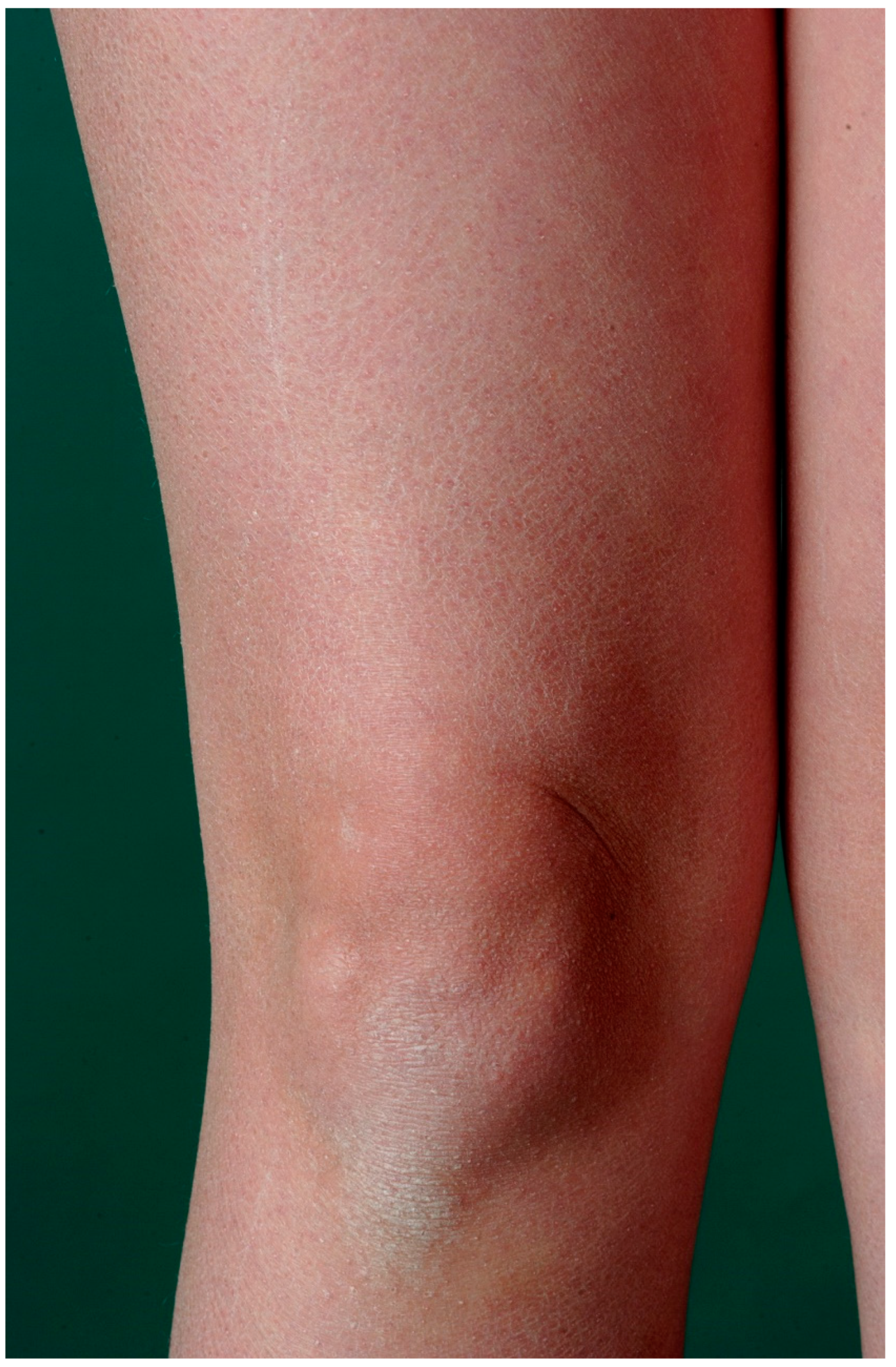 Dermatopathology 08 00017 g001