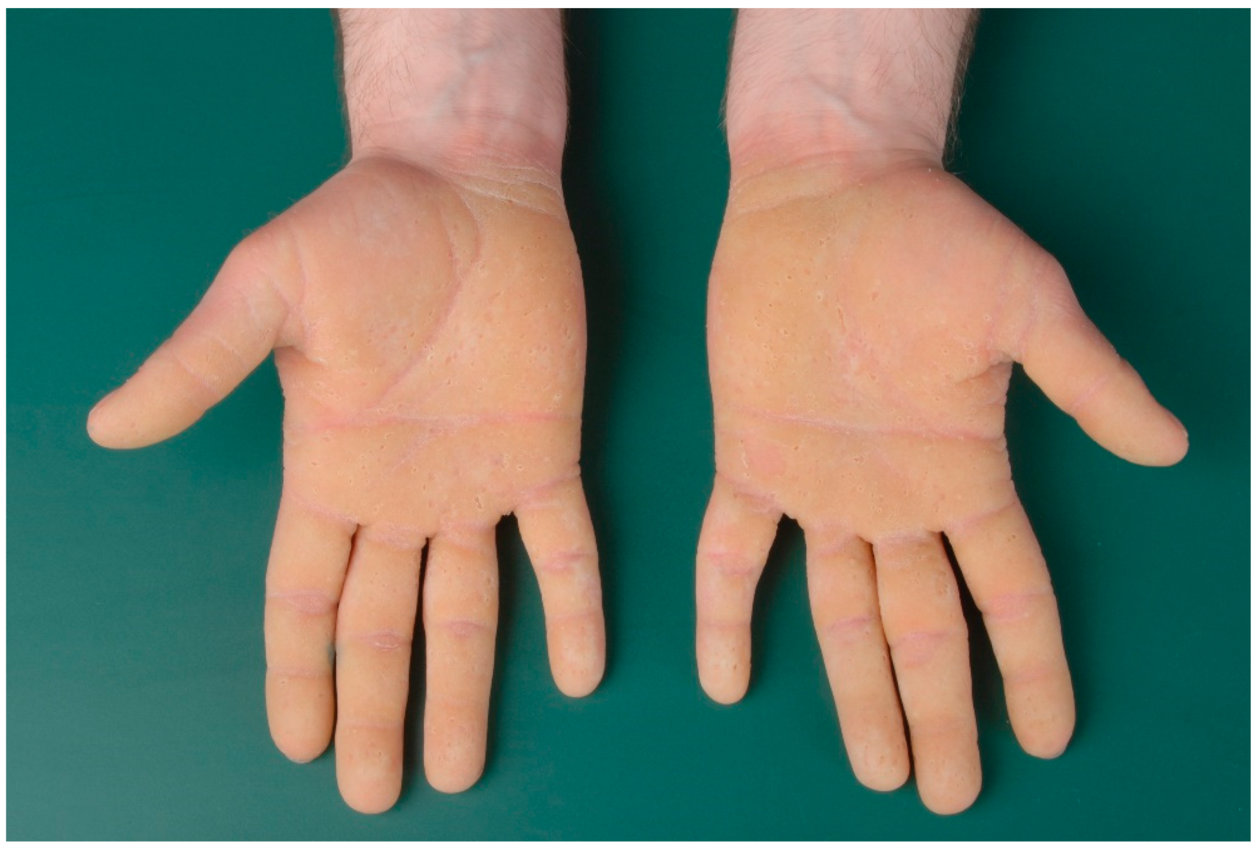 Dermatopathology 08 00017 g005