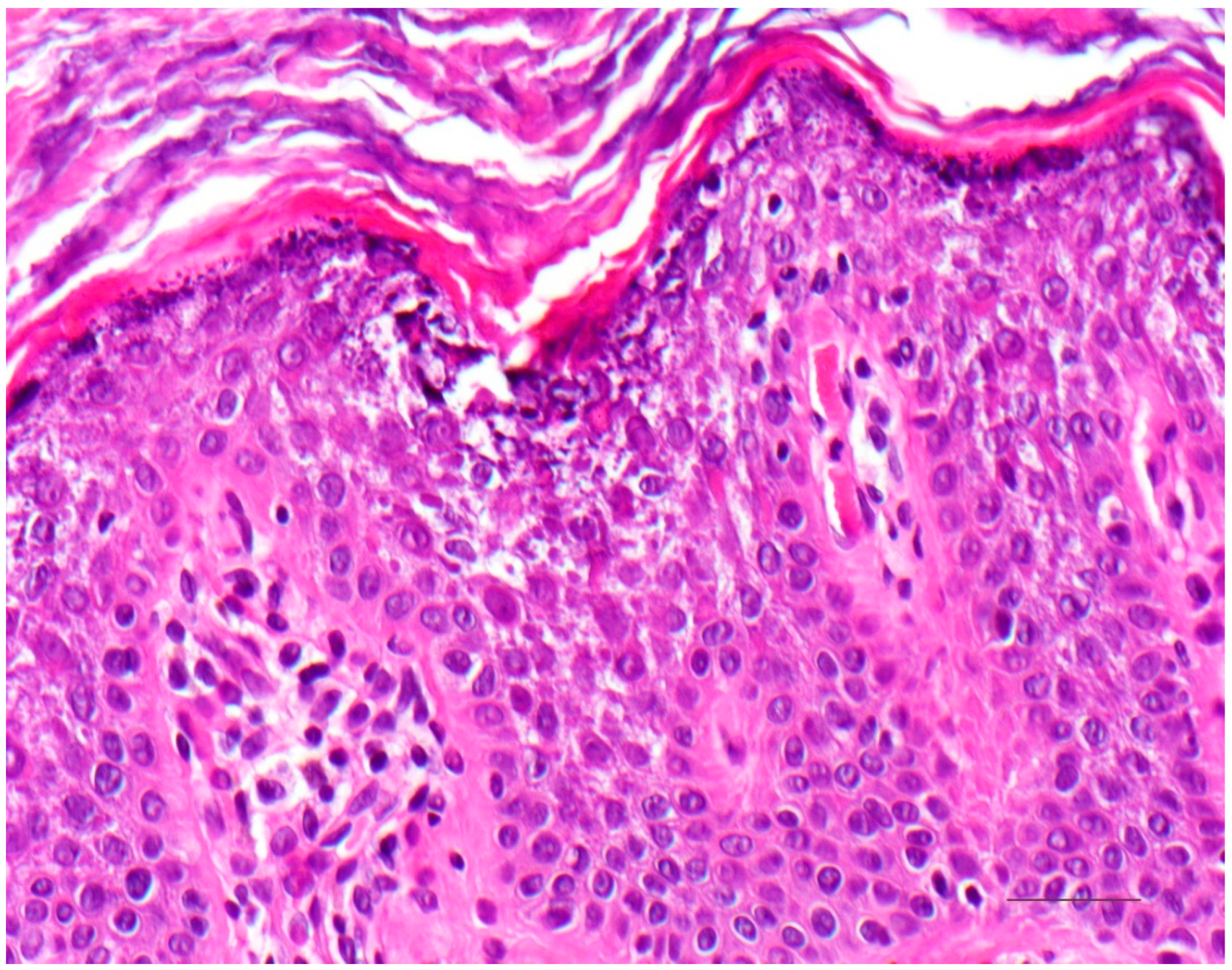 Dermatopathology 08 00017 g006