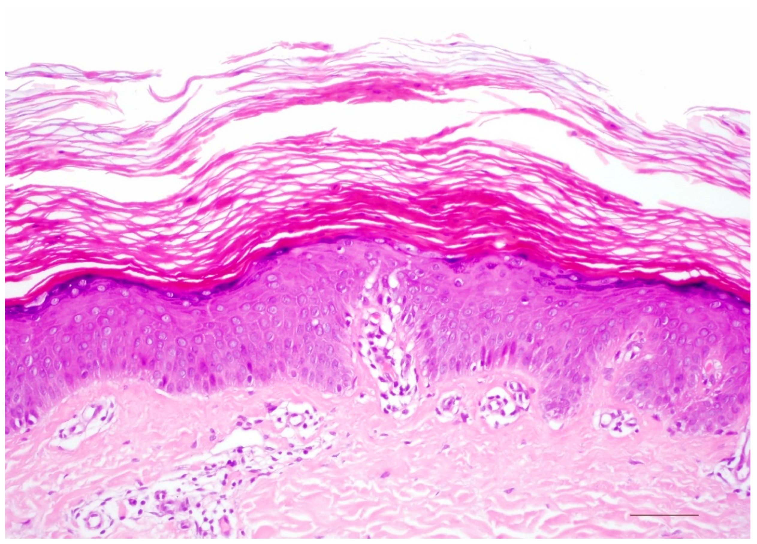 Dermatopathology 08 00017 g007