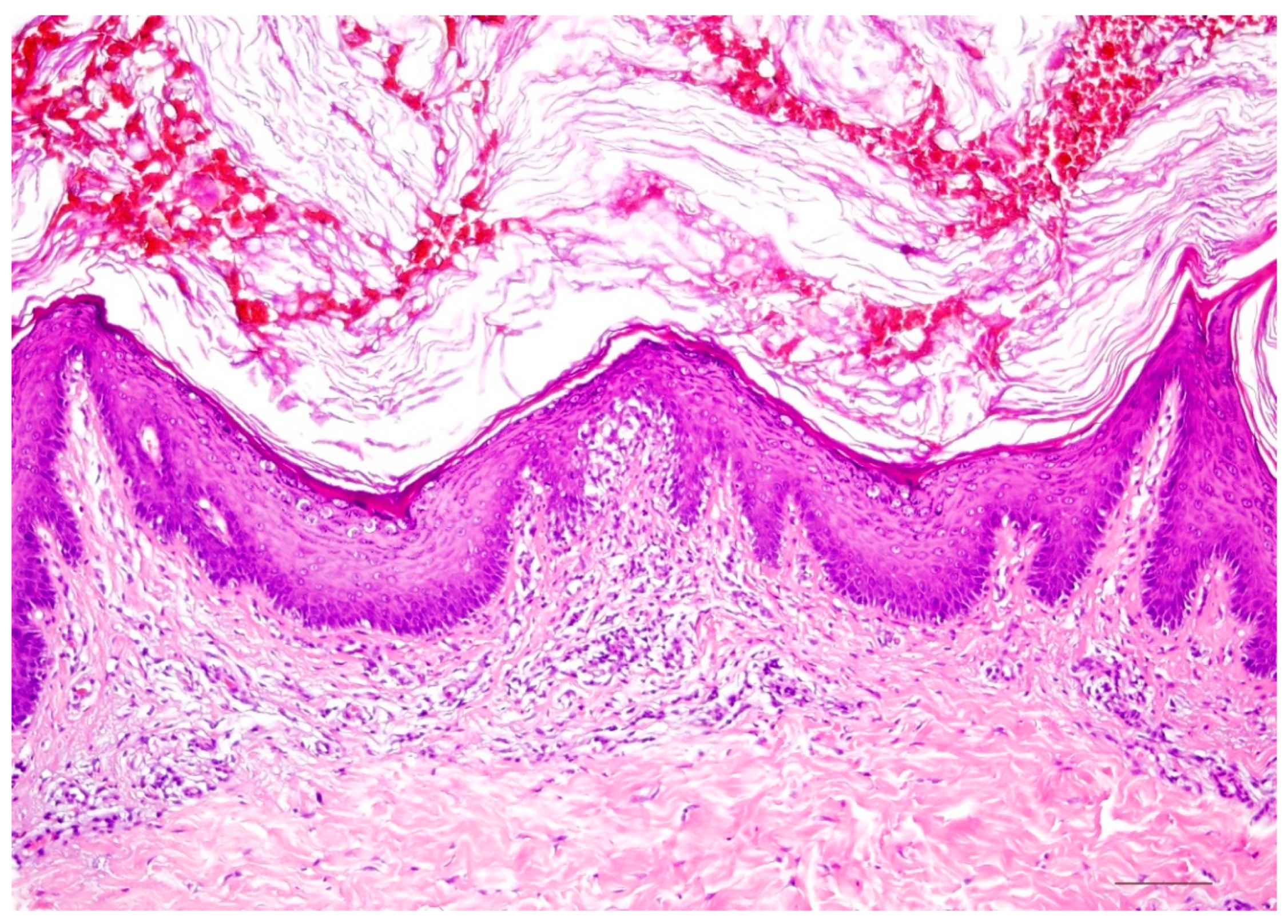 Dermatopathology 08 00017 g008