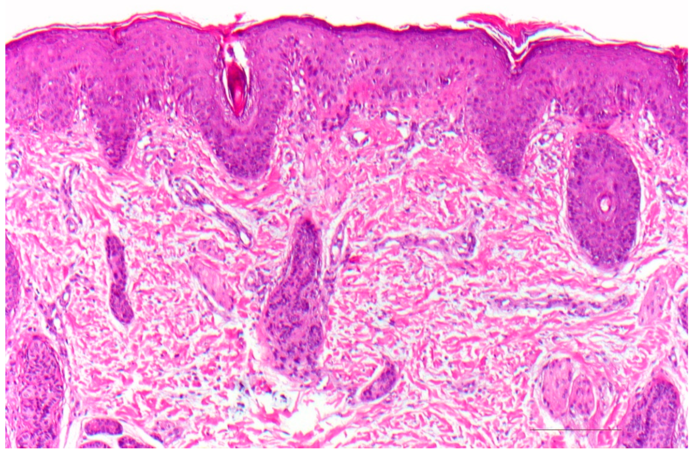Dermatopathology 08 00017 g010