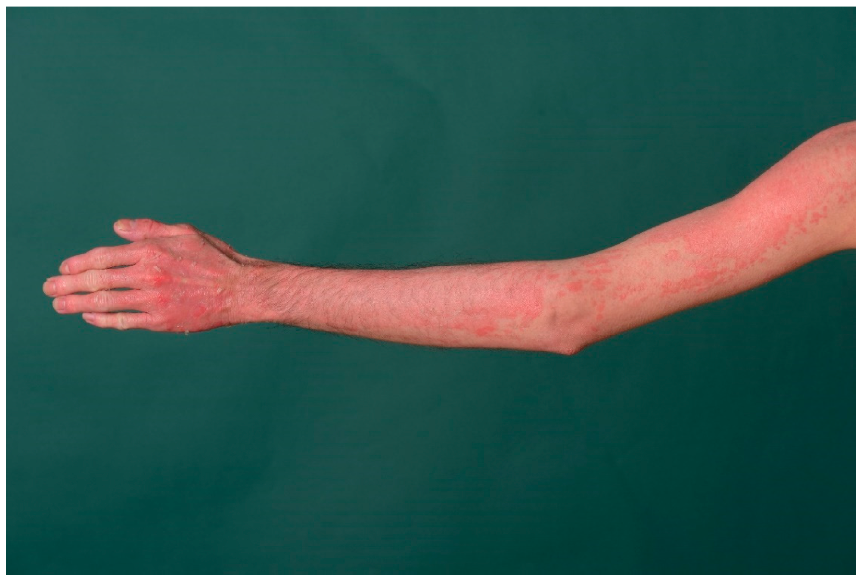 Dermatopathology 08 00017 g012