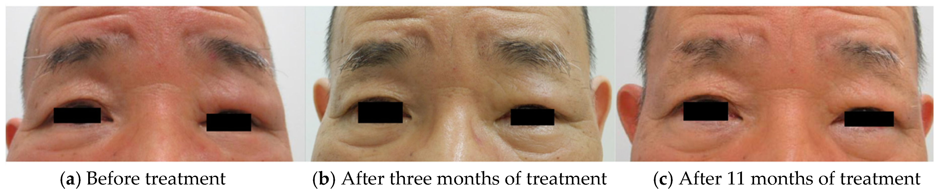Dermatopathology 08 00018 g002 Dermatopathology 08 00018 g002