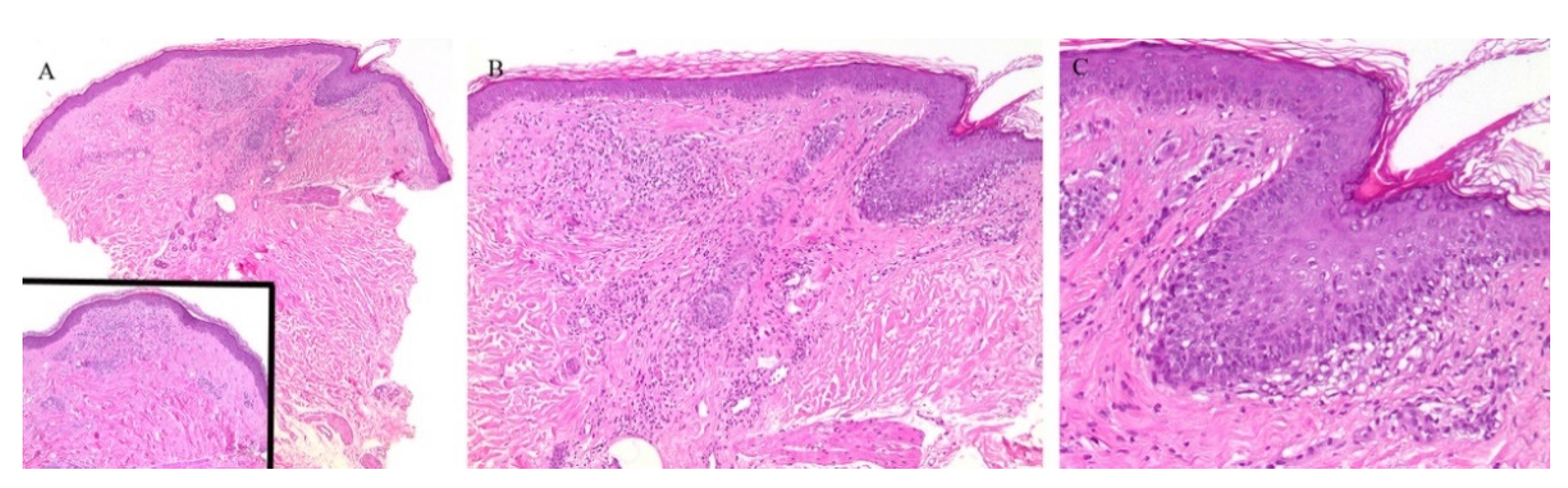Dermatopathology 08 00020 g003 Dermatopathology 08 00020 g003