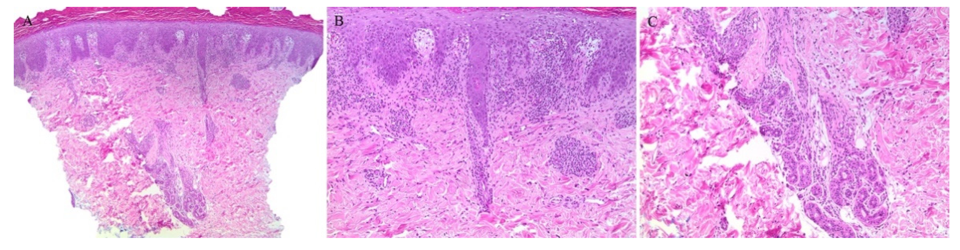 Dermatopathology 08 00020 g007 Dermatopathology 08 00020 g007