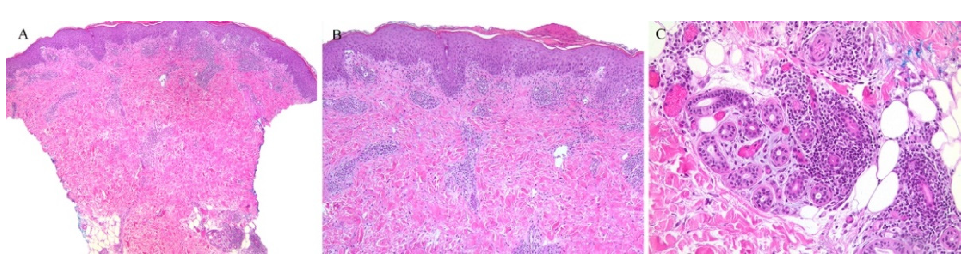 Dermatopathology 08 00020 g008 Dermatopathology 08 00020 g008