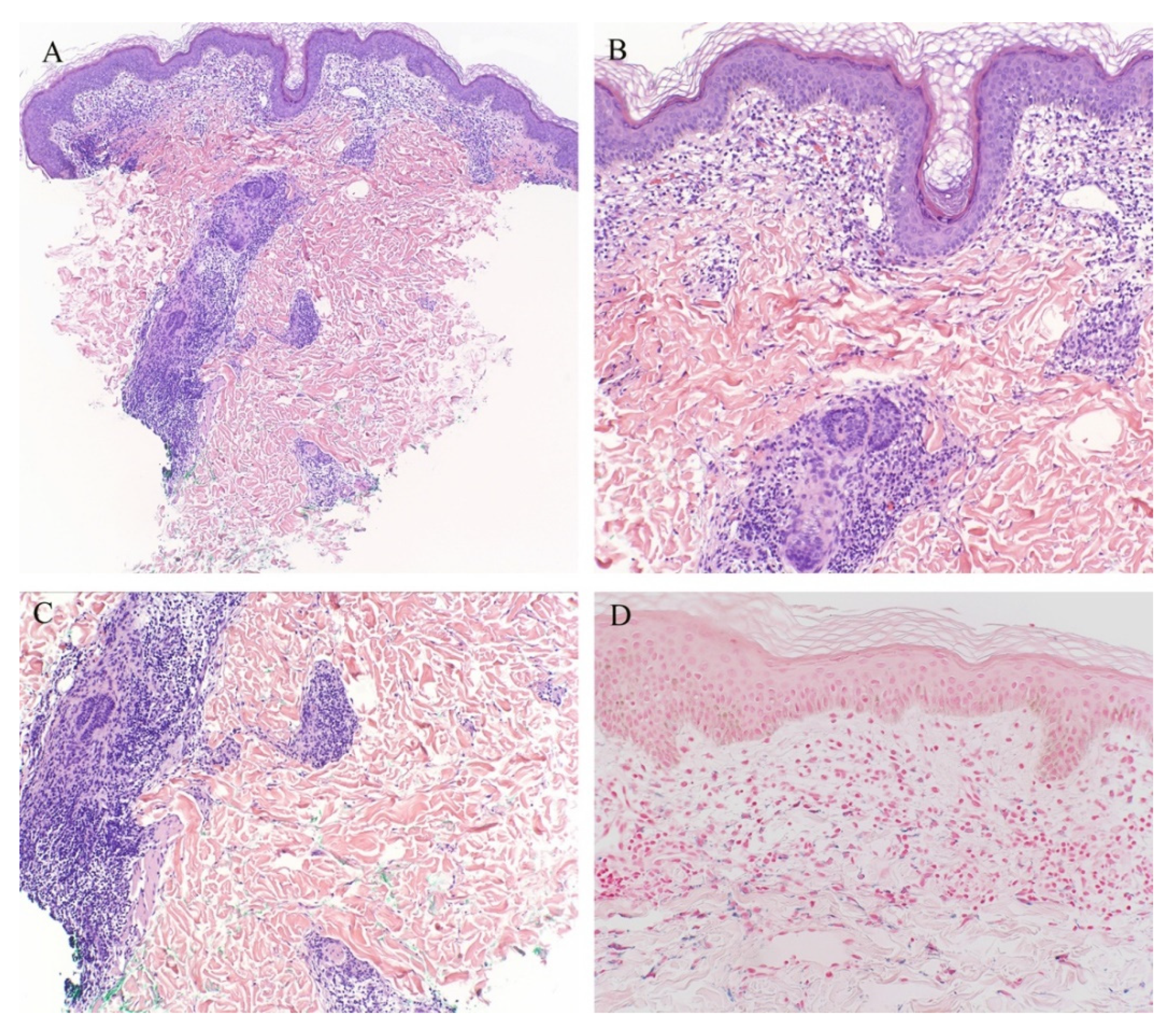 Dermatopathology 08 00020 g009 Dermatopathology 08 00020 g009