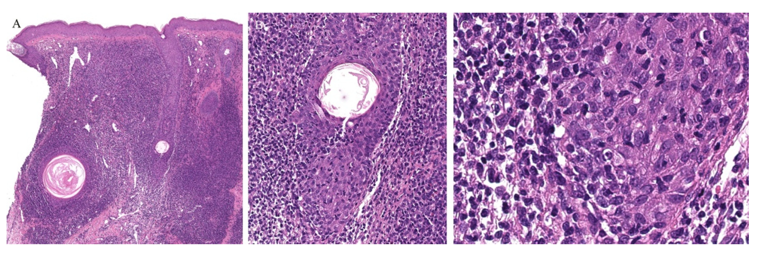 Dermatopathology 08 00020 g010 Dermatopathology 08 00020 g010