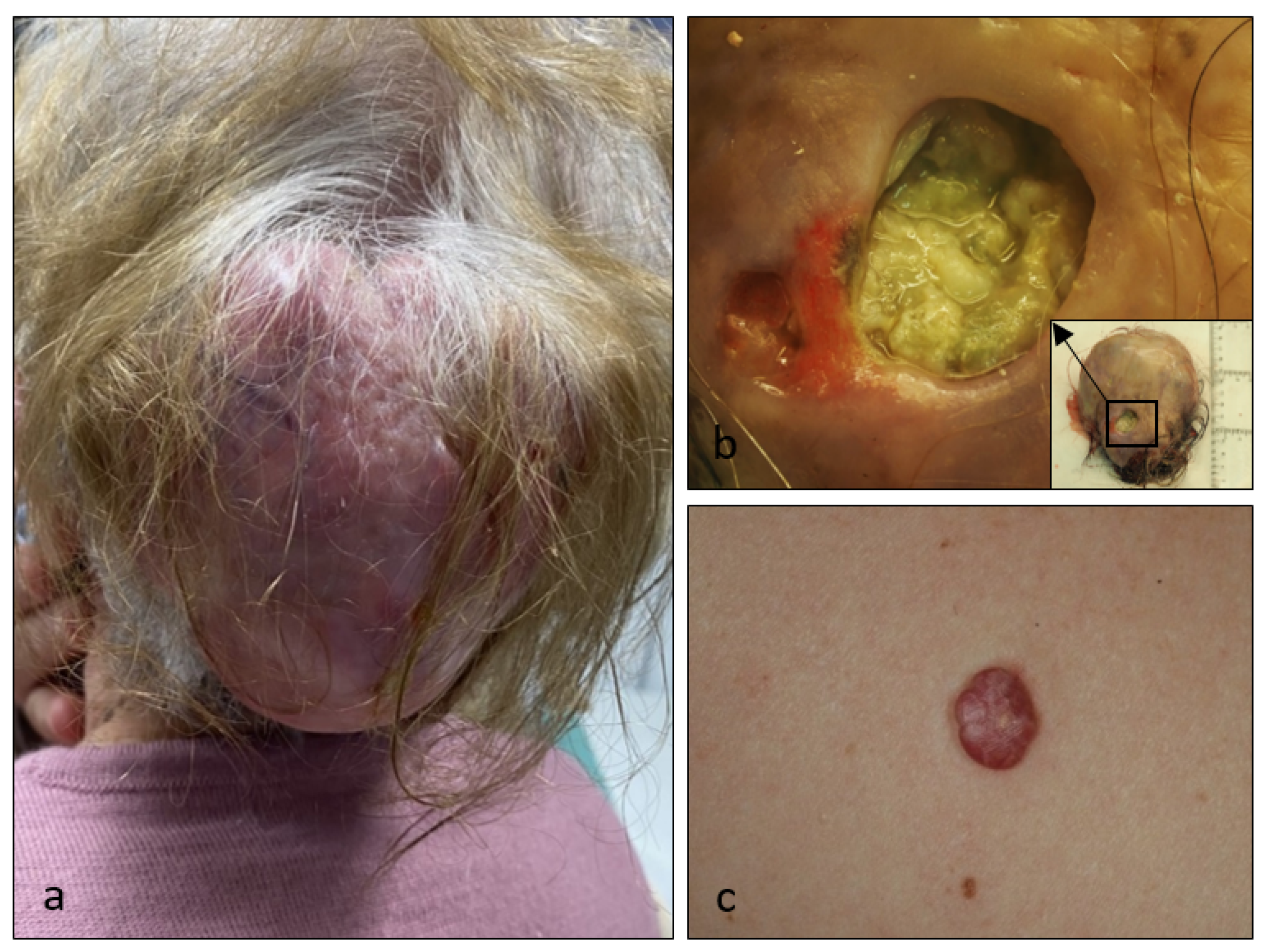 Dermatopathology 08 00021 g001