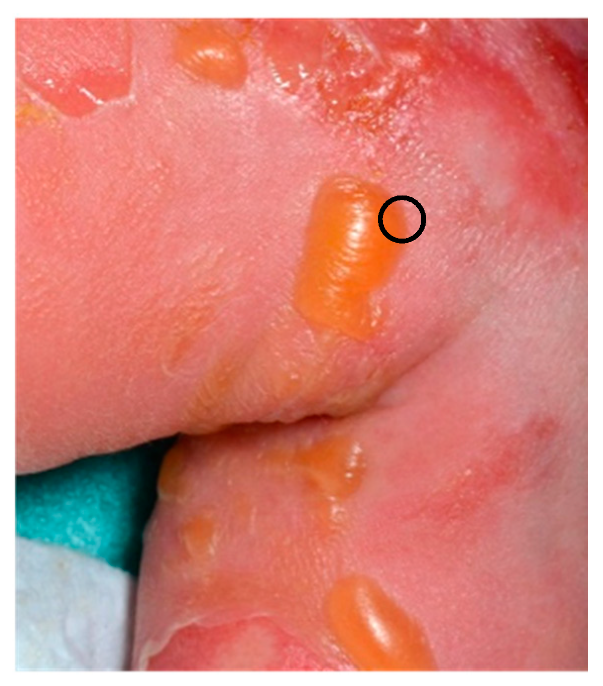 Dermatopathology 08 00022 g001