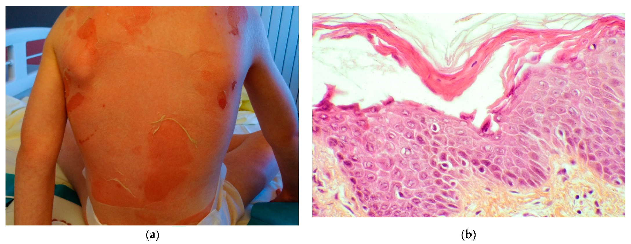 Dermatopathology 08 00022 g002