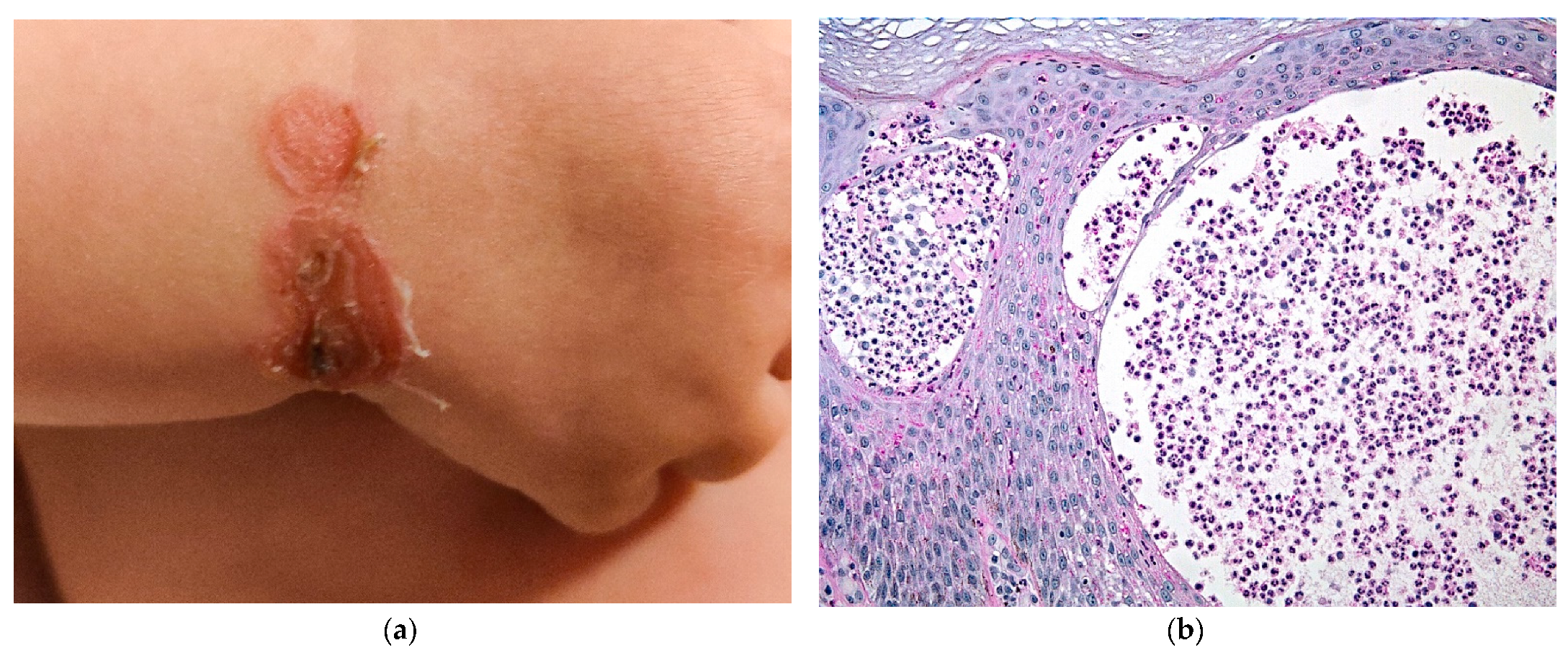 Dermatopathology 08 00022 g003