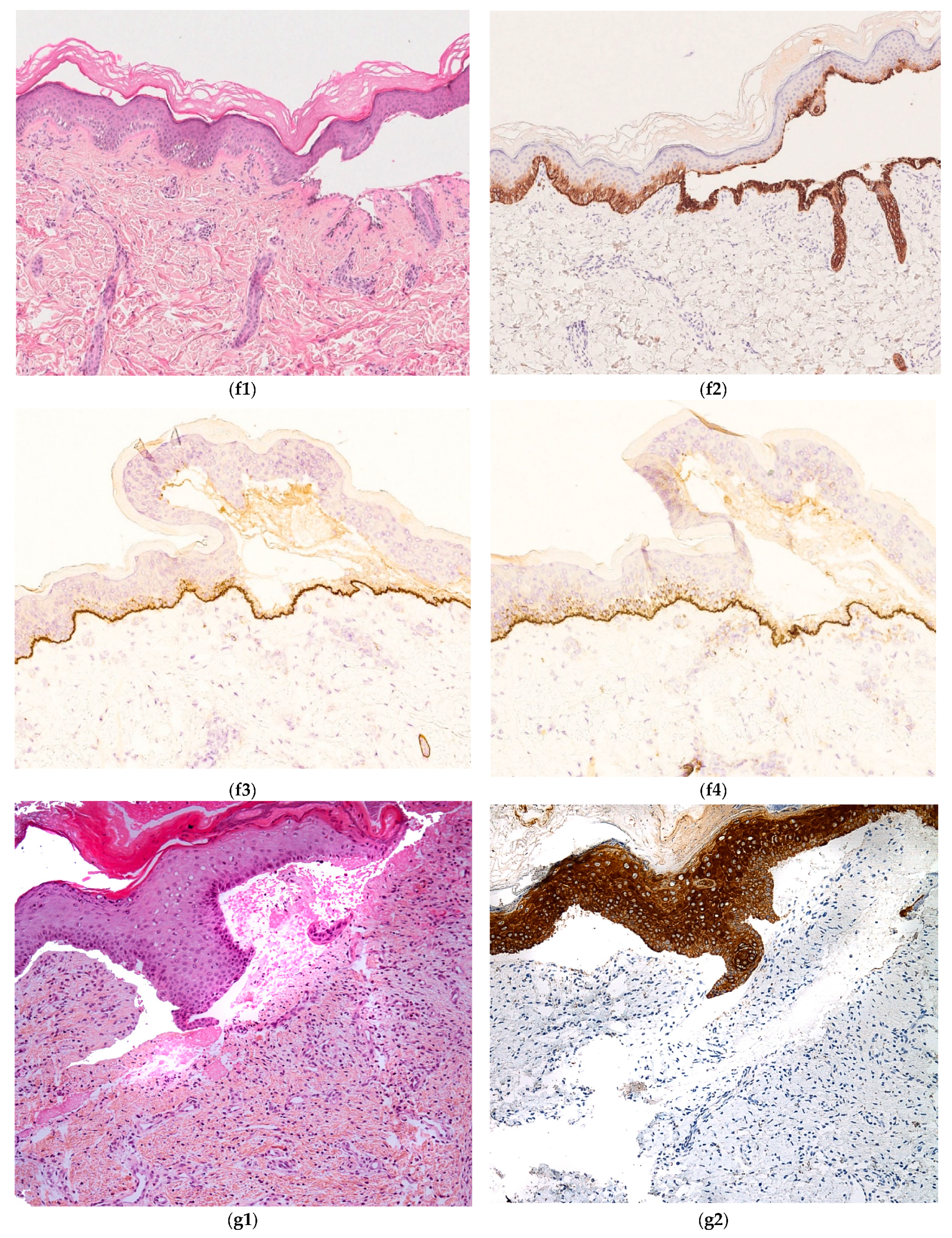Dermatopathology 08 00022 g005b