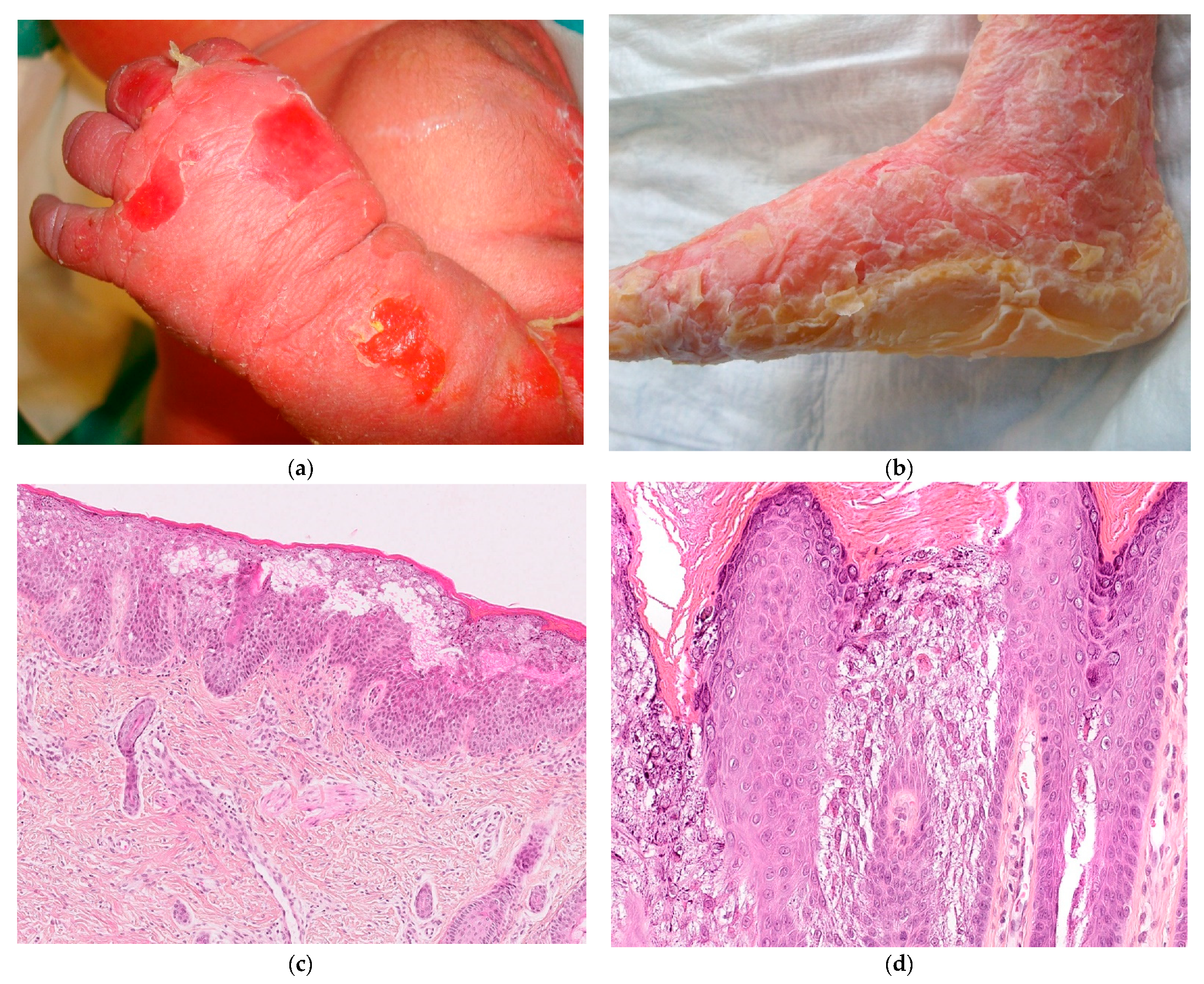 Dermatopathology 08 00022 g007a