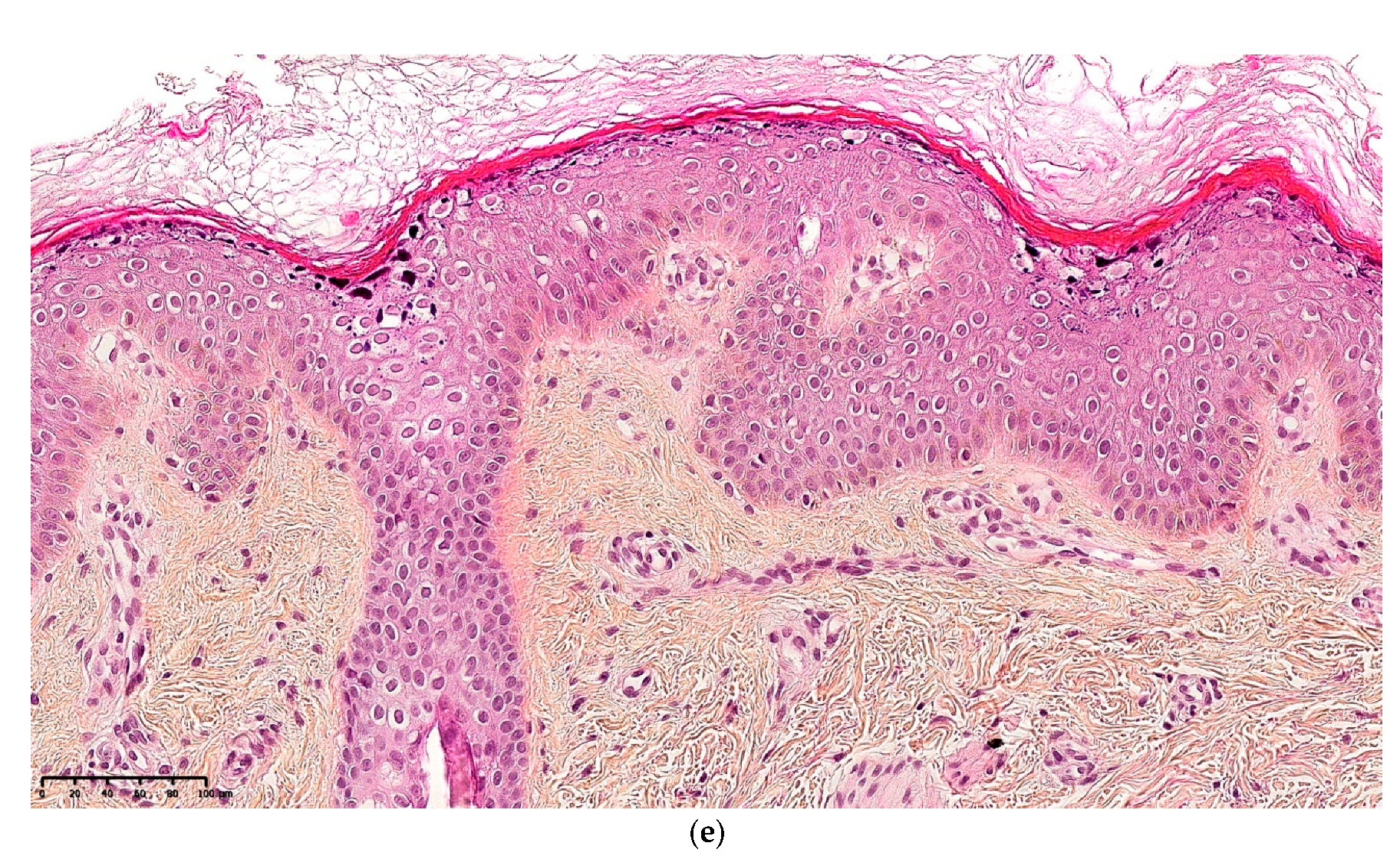 Dermatopathology 08 00022 g007b