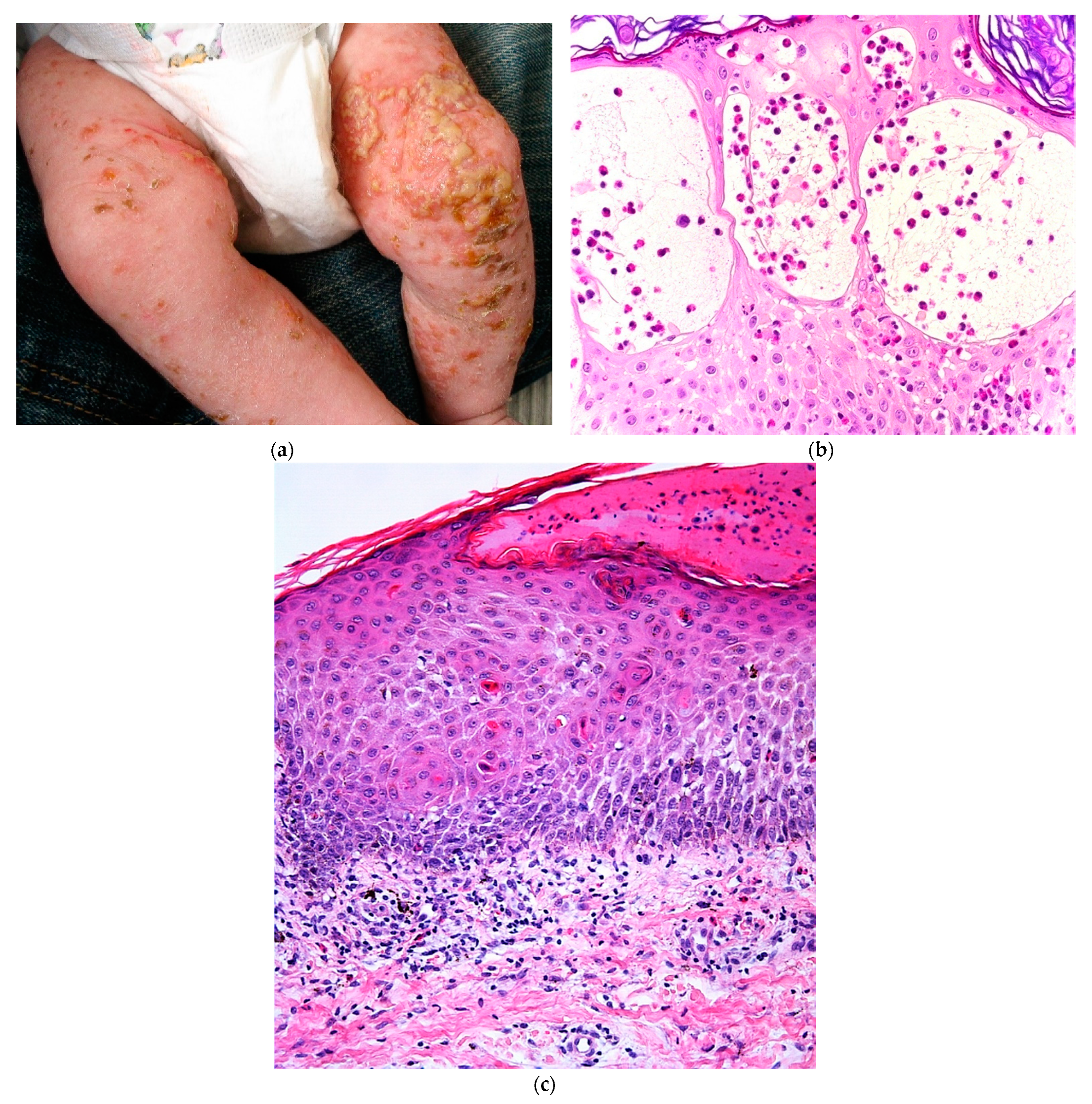Dermatopathology 08 00022 g008