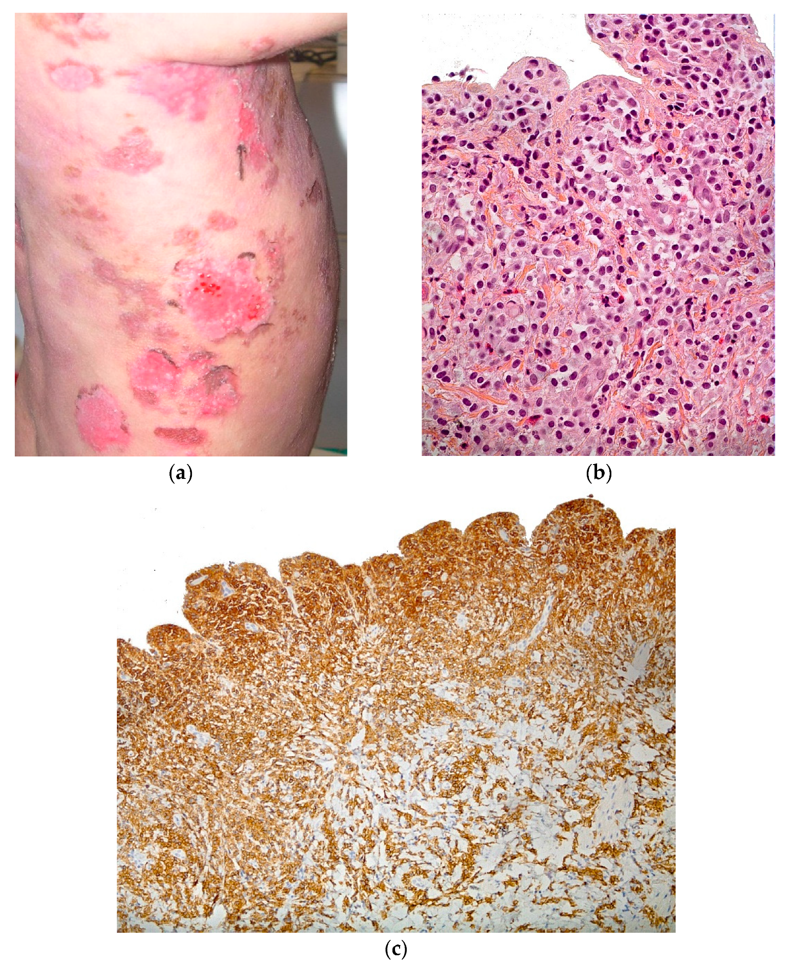 Dermatopathology 08 00022 g009