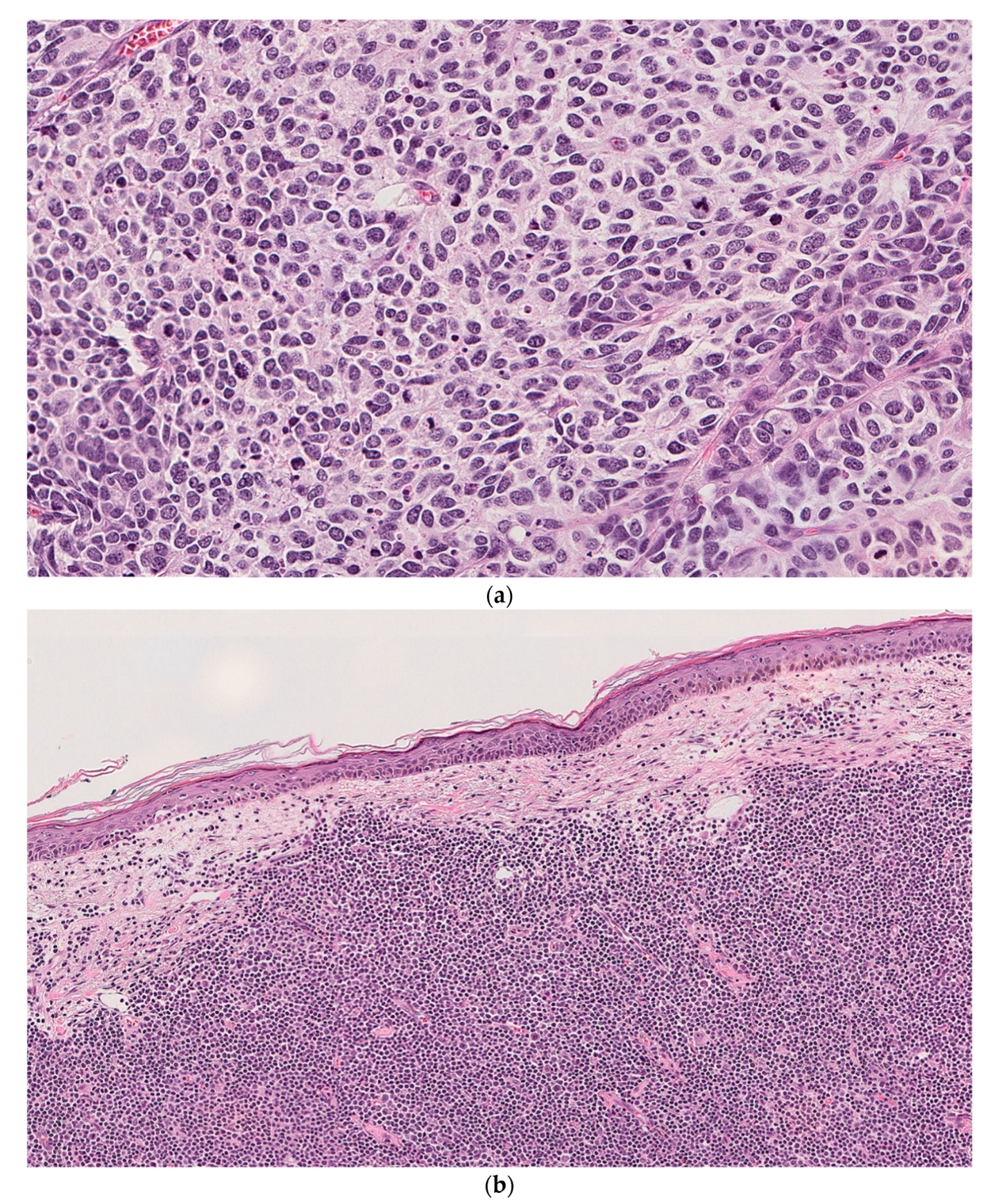 Dermatopathology 08 00025 g003a