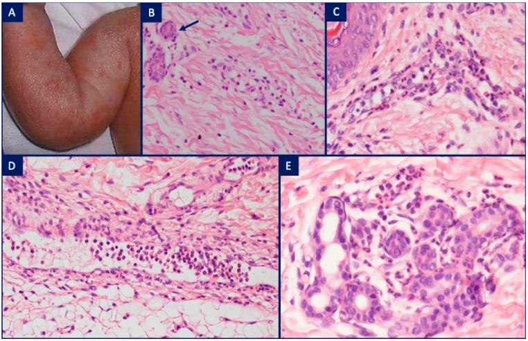 Dermatopathology 08 00026 g003
